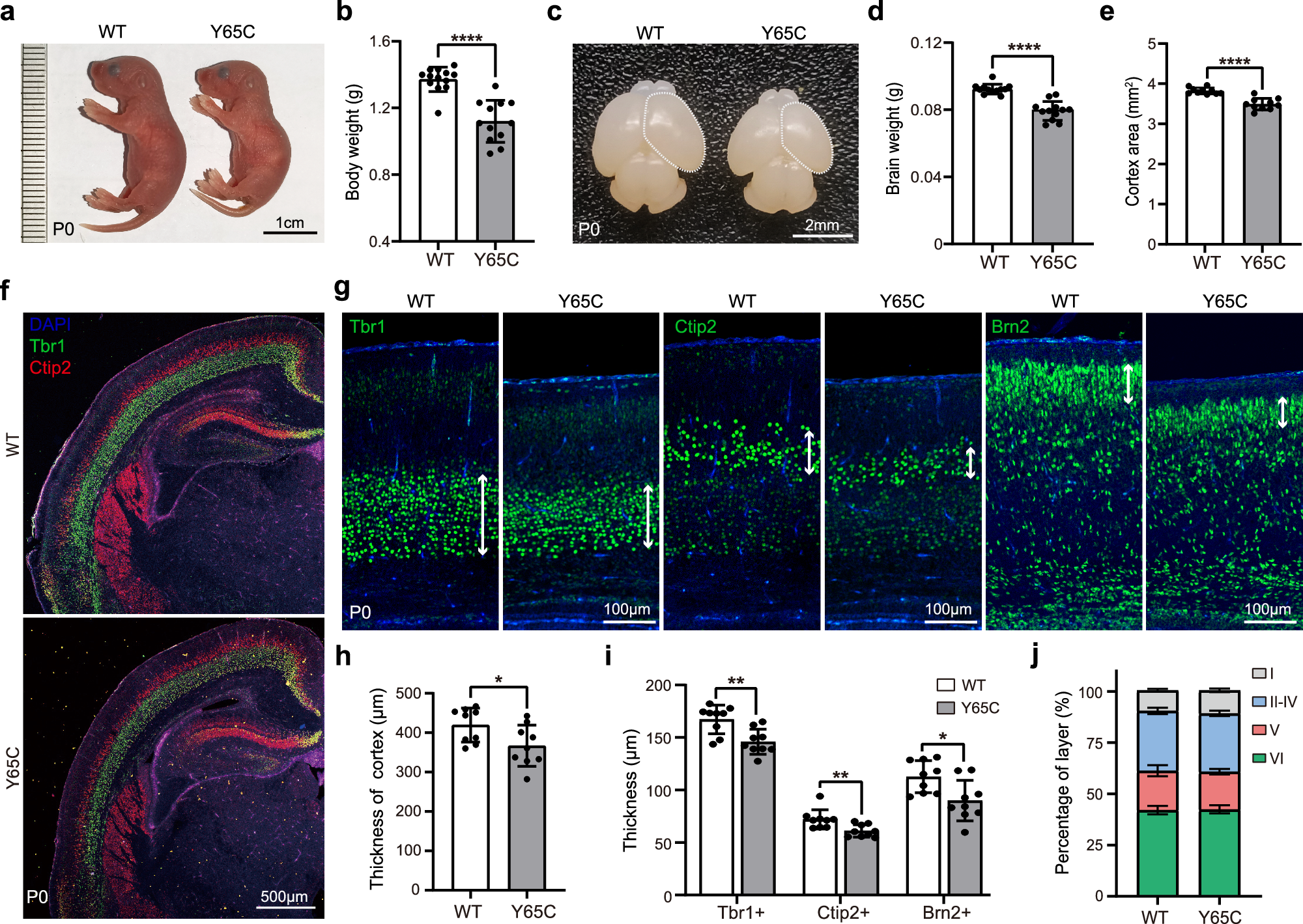 Fig. 1: Pqbp1Y65C/Y mice exhibit short stature, and microcephaly.