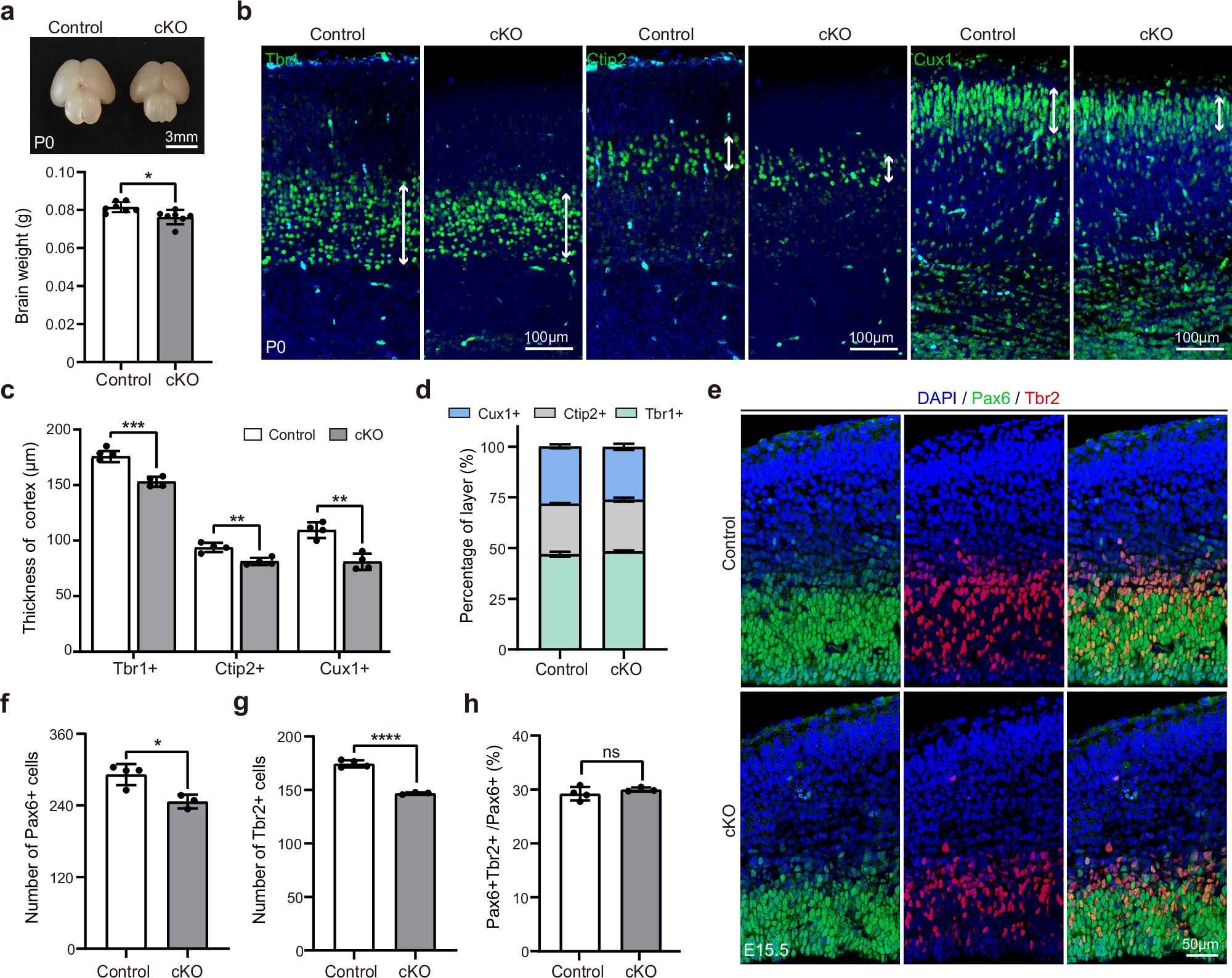 Fig. 5: Nestin-cKO mice display microcephaly without deficits in the AP-to-BP transition.