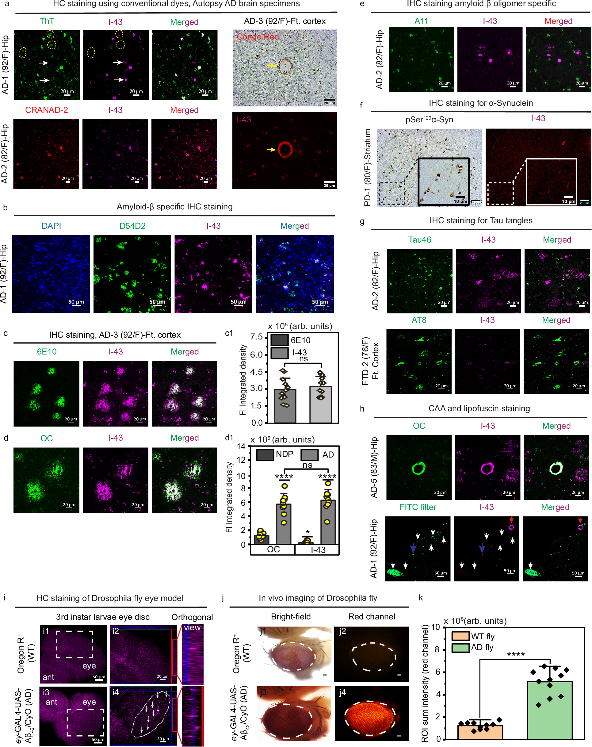 Fig. 7: Confocal imaging of postmortem brain tissues from AD, FTD, and PD patients upon treatment with I-43.
