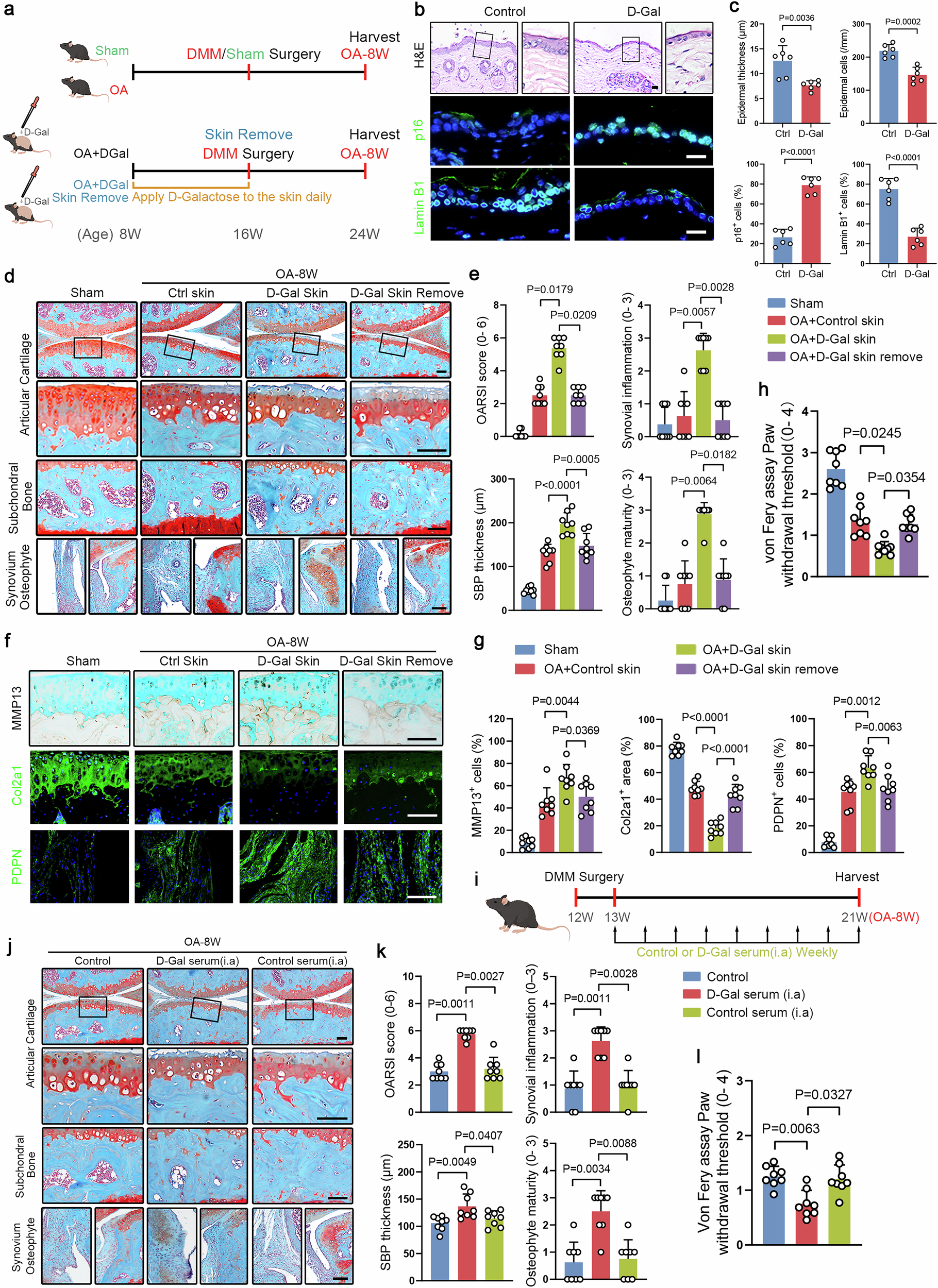Fig. 1: Premature skin aging promotes traumatic osteoarthritis (OA) progression in mice.