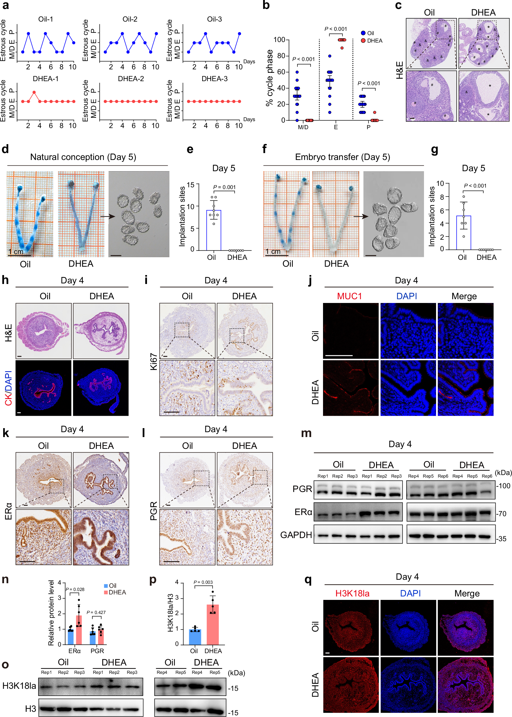 Fig. 4: PCOS mice exhibit excessive uterine ERα and H3K18la along with abnormal endometrial receptivity.