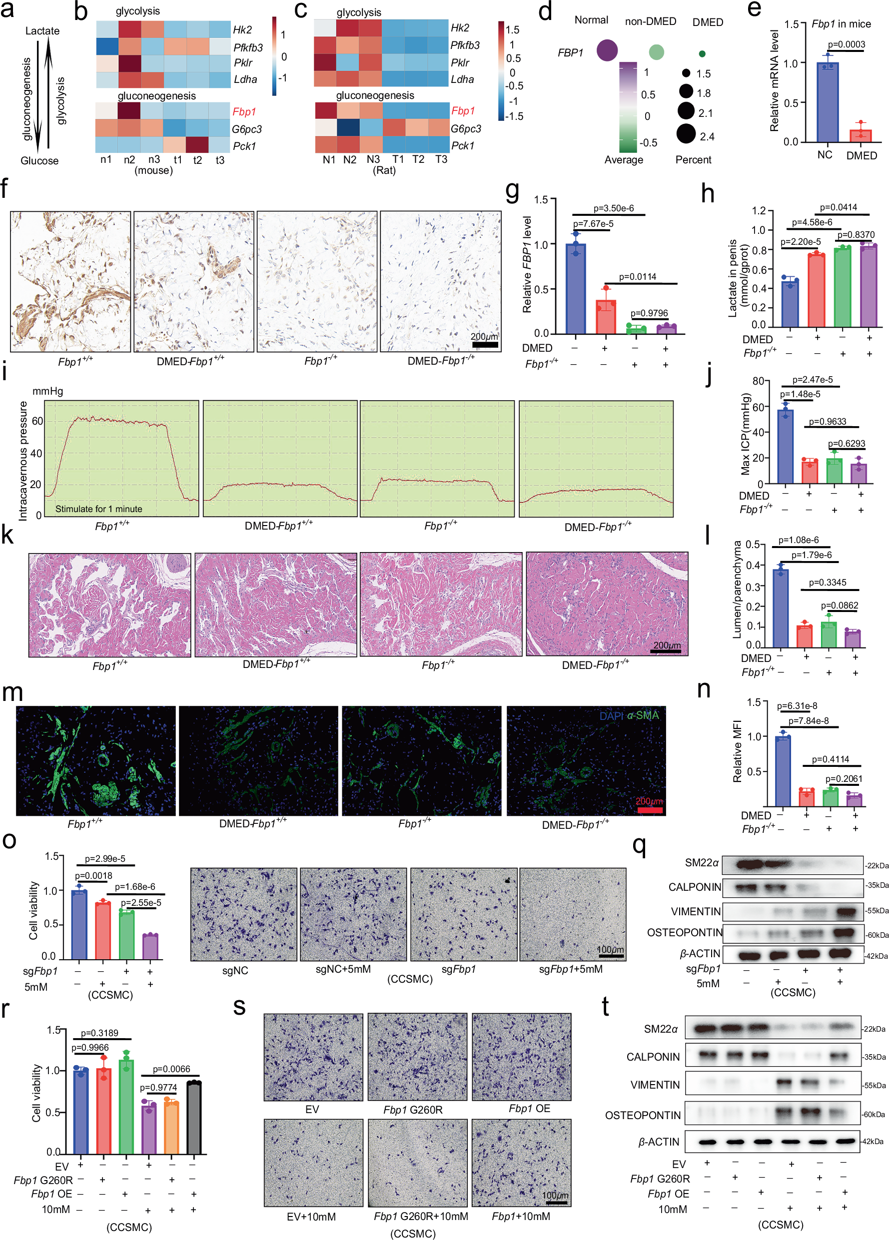 Fig. 2: Fbp1 is a key factor for cavernosal lactate accumulation in DMED.