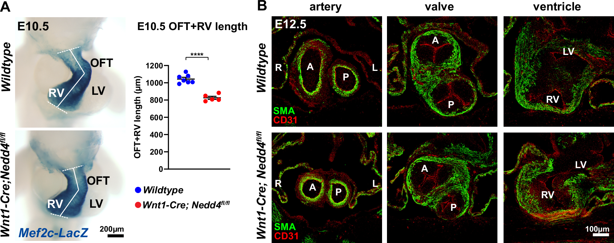 Fig. 2: Hearts of Wnt1-Cre; Nedd4fl/fl embryos exhibit shortened outflow tract and incomplete outflow tract rotation.