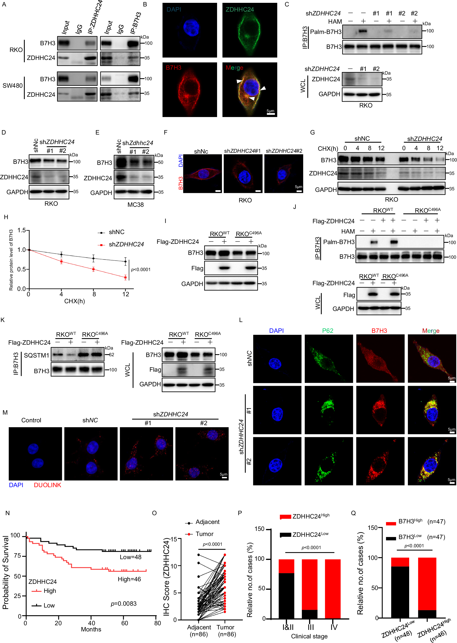 Fig. 4: ZDHHC24-mediated B7H3 palmitoylation promotes protein stability and is linked to poor colorectal cancer outcomes.