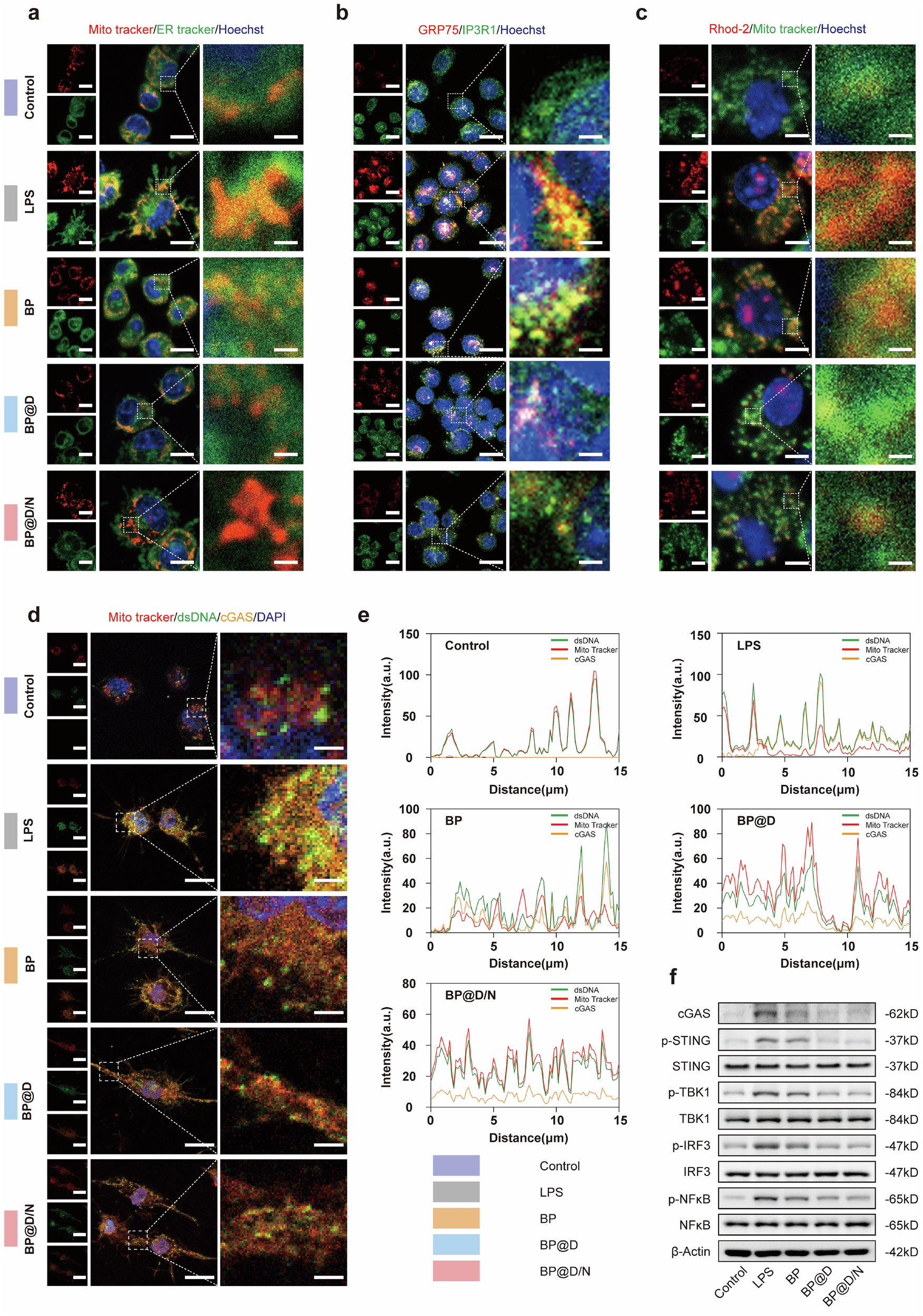 Fig. 5: Camouflaged nanorobots inhibit the pathological formation of MAMs and mtDNA leakage in Mφ.