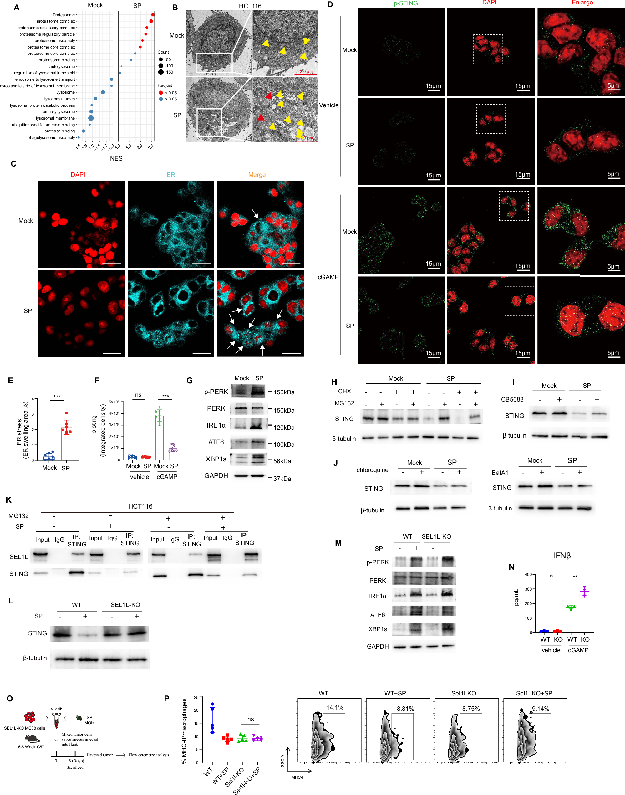 Fig. 6: Intracellular SP induce ER stress activation ERAD pathway degrading STING protein.