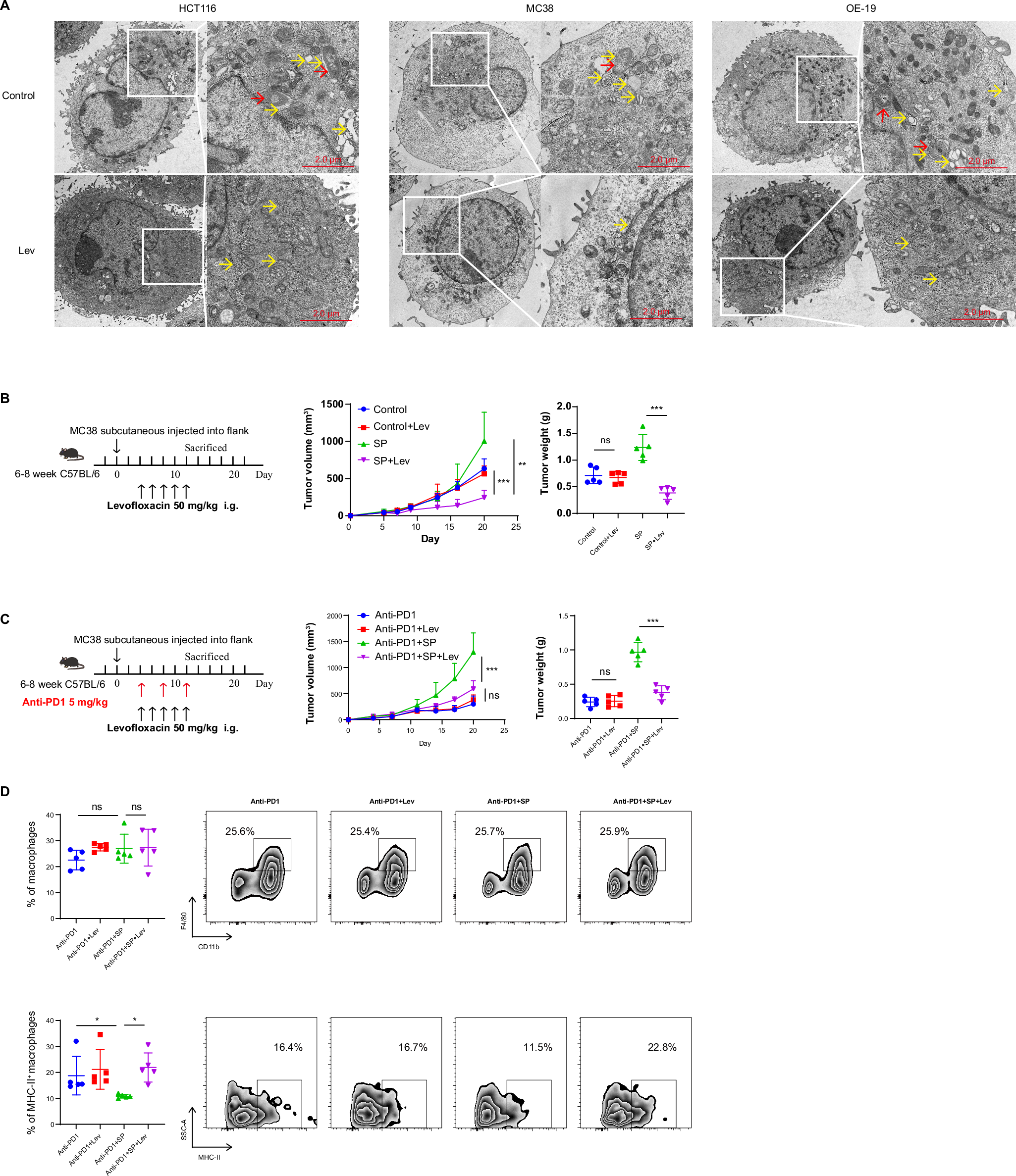 Fig. 8: Levofloxacin rescued SP promoting tumor progression.