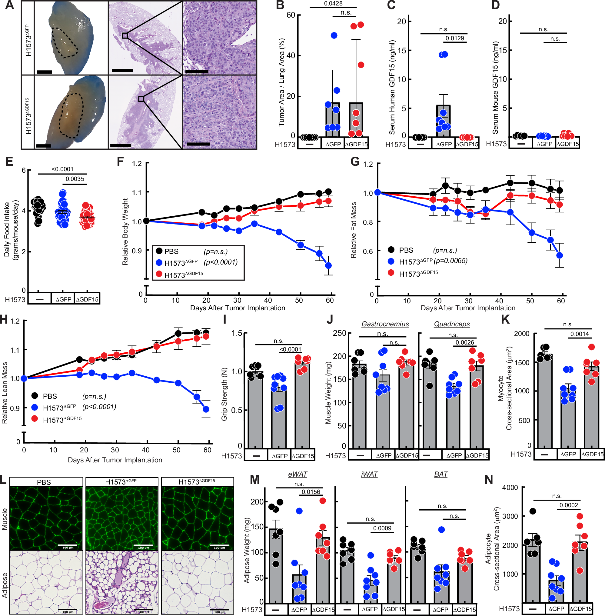 Fig. 4: GDF15 silencing in STK11/LKB1-mutated NSCLC tumors orthotopically xenotransplanted into mice that have high circulating GDF15 concentrations.
