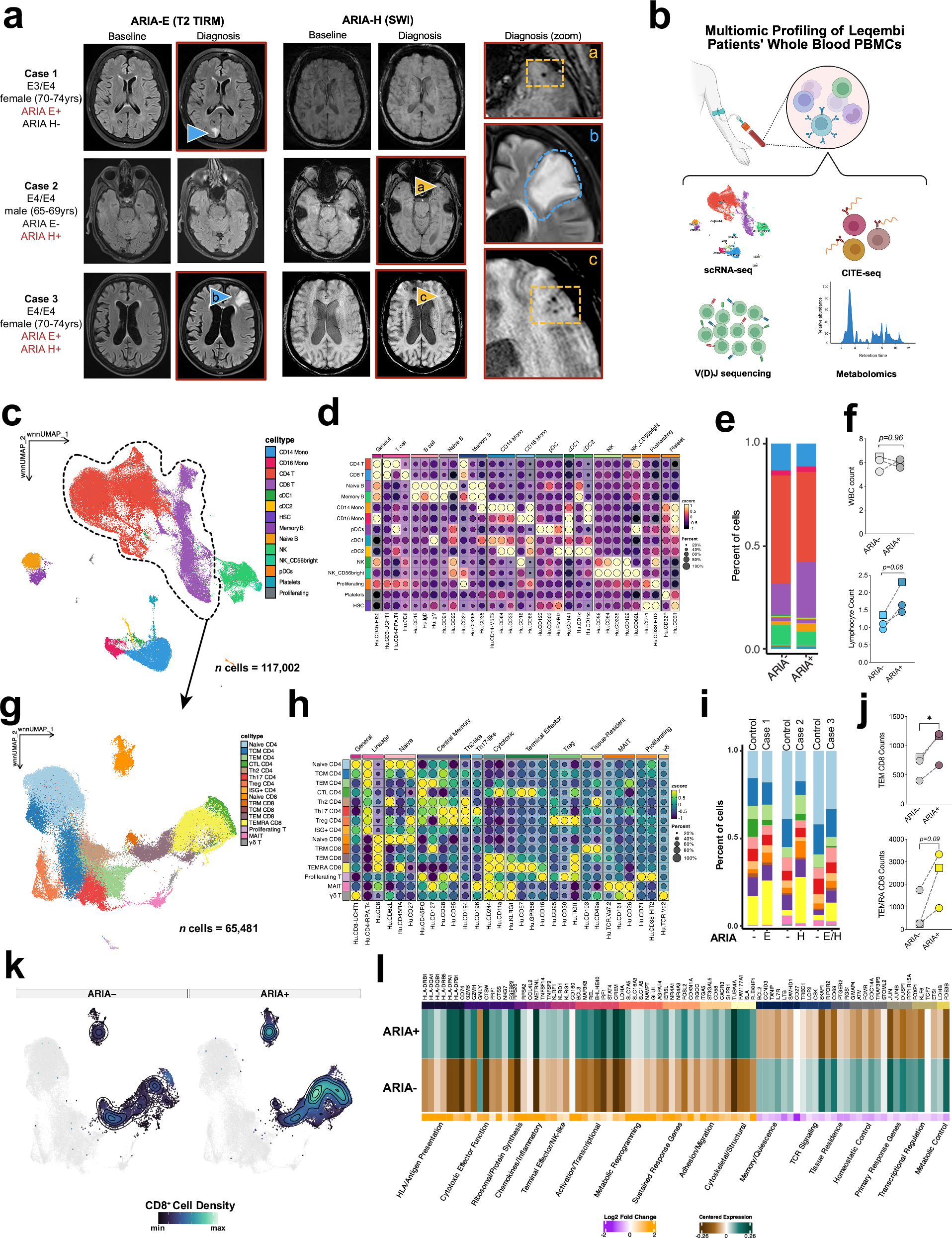 Fig. 1: ARIA is associated with expansion of peripheral CD8⁺ TEMRA cells.