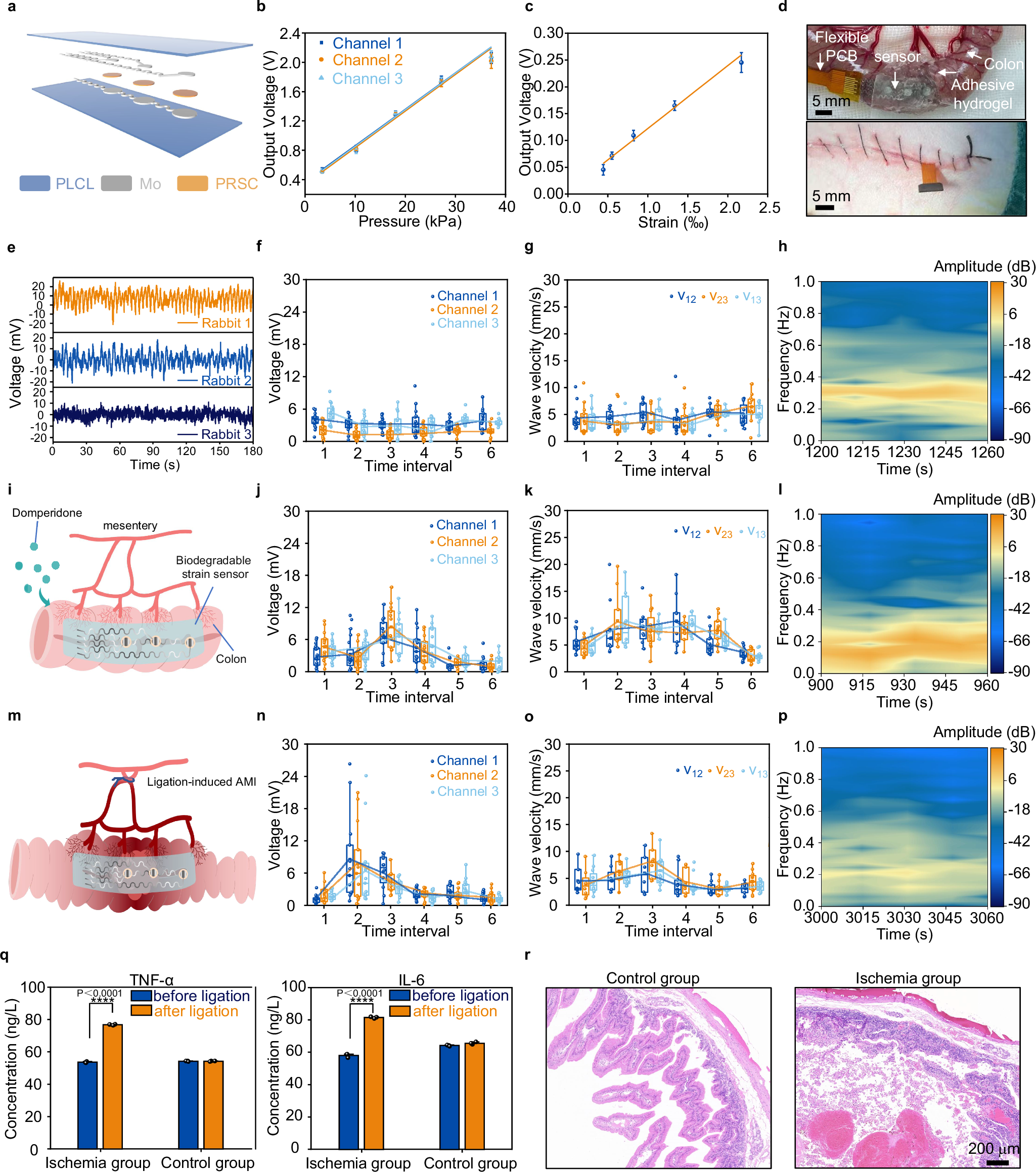 Fig. 6: Biodegradable piezoelectric strain sensors based on PRSC for intestinal peristalsis monitoring.