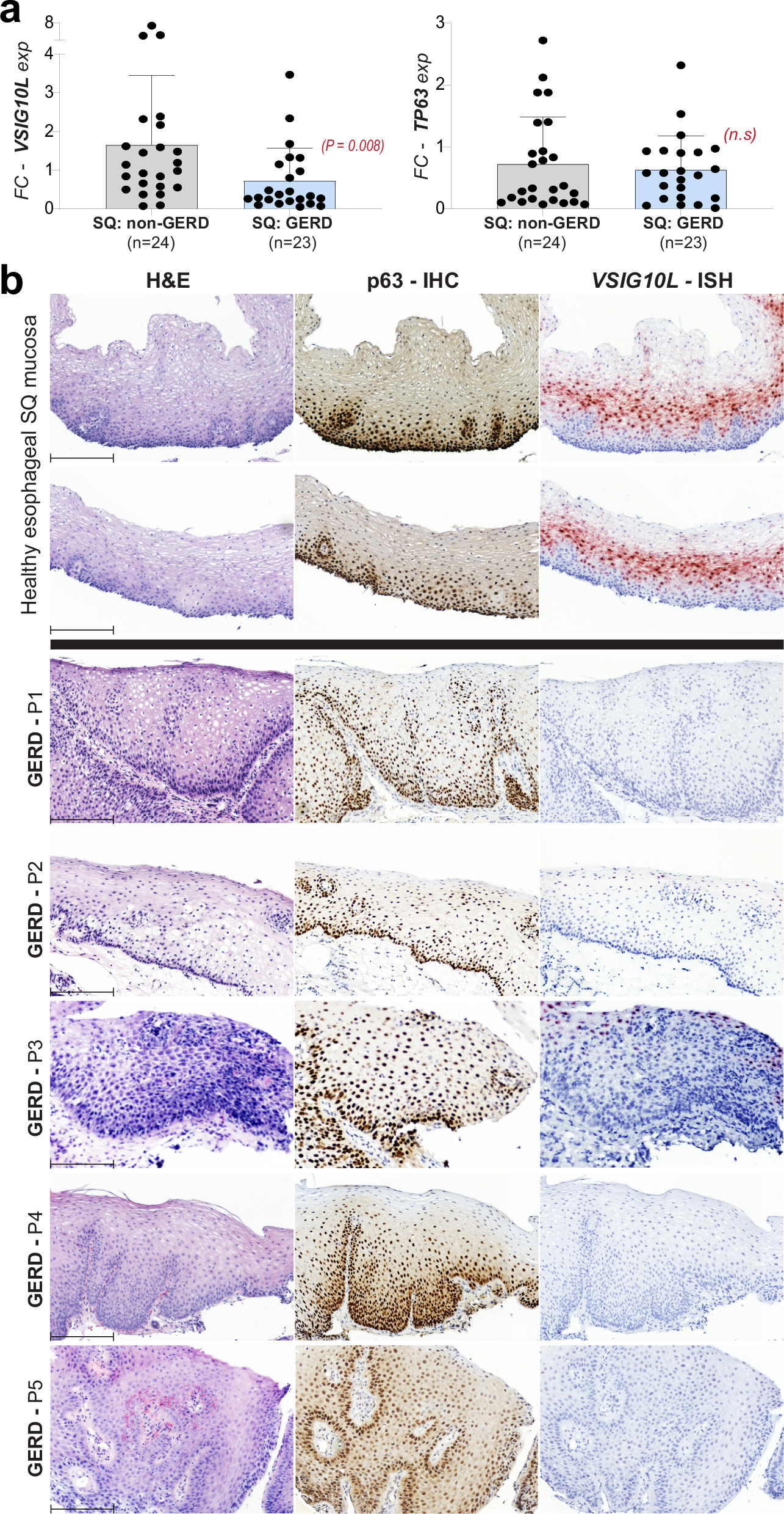 Fig. 6: Chronic reflux injury suppresses VSIG10L expression in the distal esophagus.