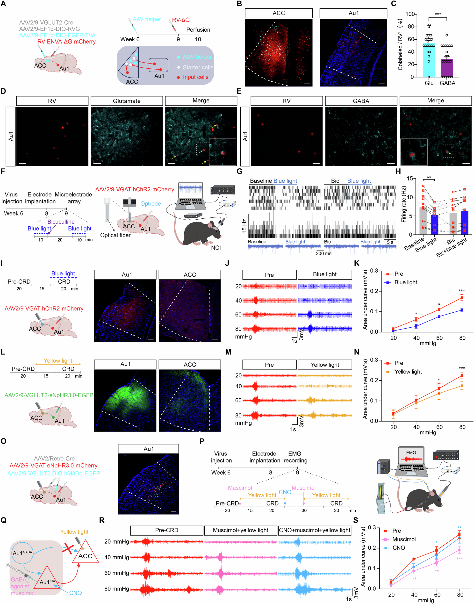 Fig. 3: Au1GABA neurons mediate visceral analgesia through enhanced GABAergic output to ACCGlu in synergy with attenuated glutamatergic transmission via Au1Glu.