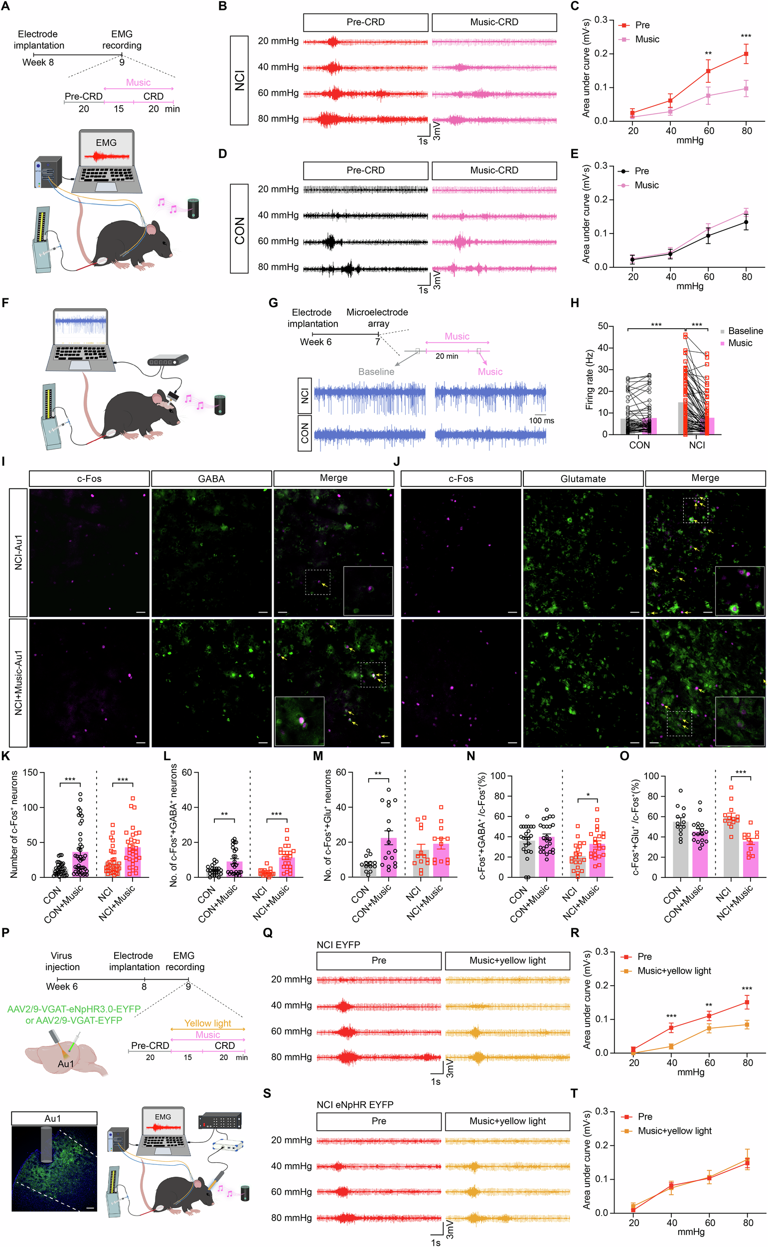 Fig. 4: Music alleviates visceral hypersensitivity in NCI mice by enhancing Au1GABA neuronal activity.
