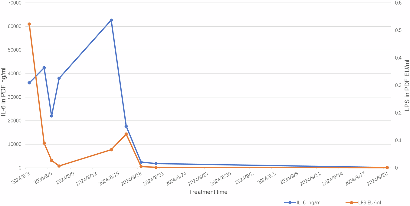 Fig. 4: Follow-up on IL-6 and LPS levels in dialysate effluent before and after phage treatment.