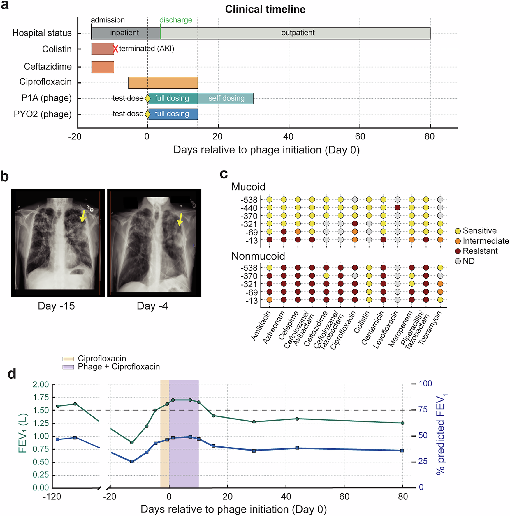 Fig. 1: Phage–ciprofloxacin coadministration drives rapid functional recovery during acute-on-chronic pulmonary exacerbation in cystic fibrosis.