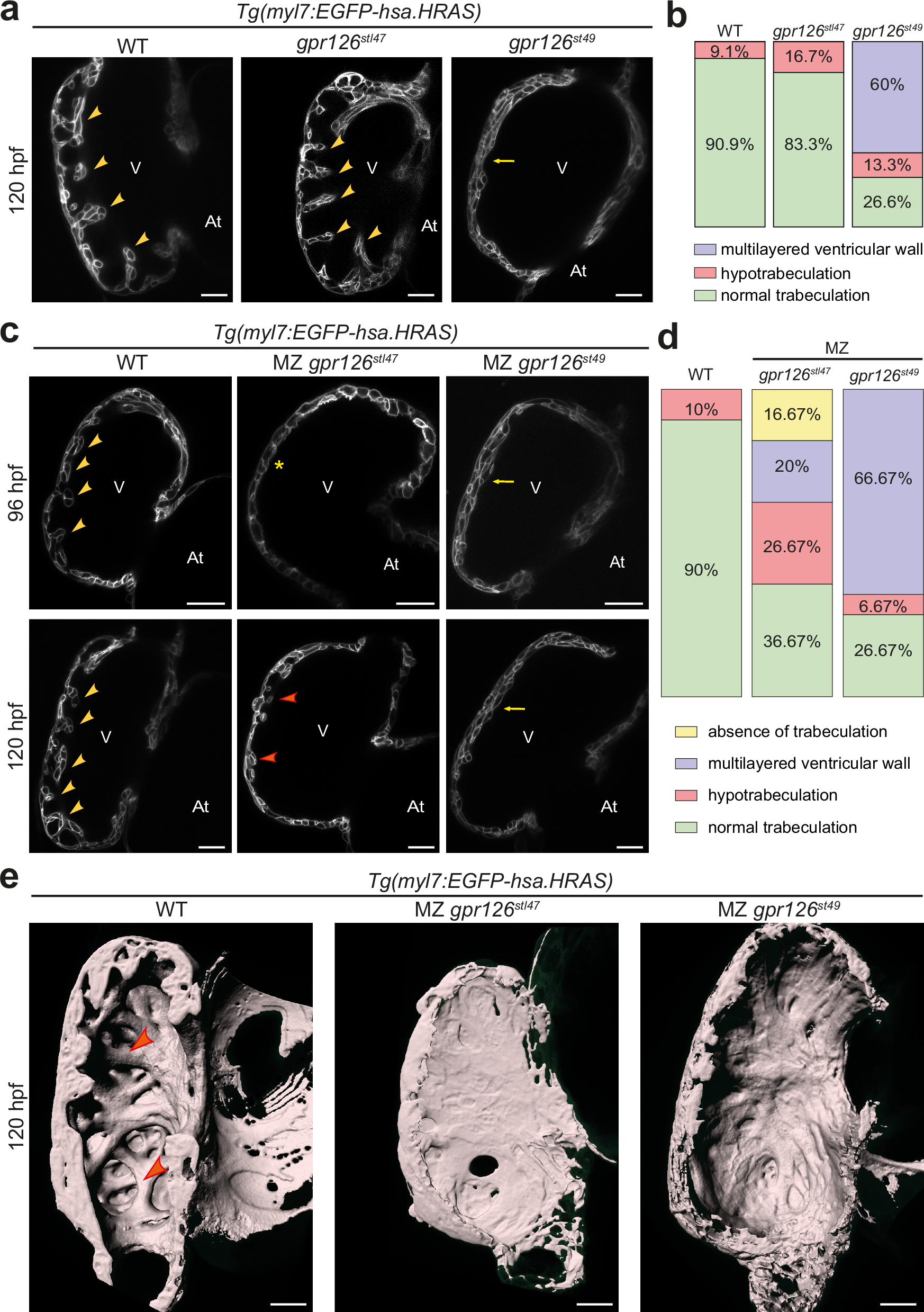 Fig. 2: Gpr126-NTF and -CTF are required for trabeculation.