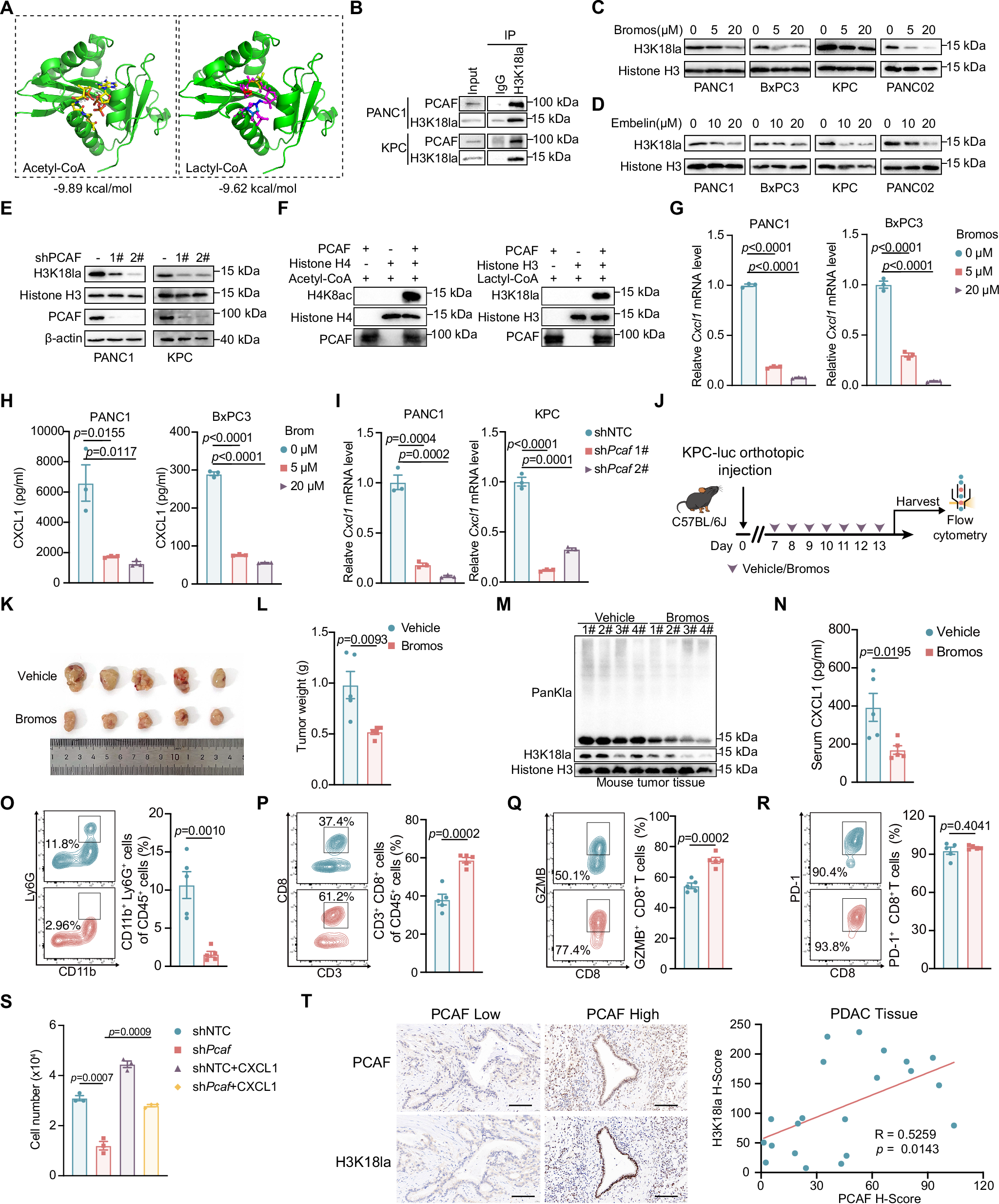 Fig. 4: PCAF serves as a histone lactyltransferase for H3K18 in PDAC.