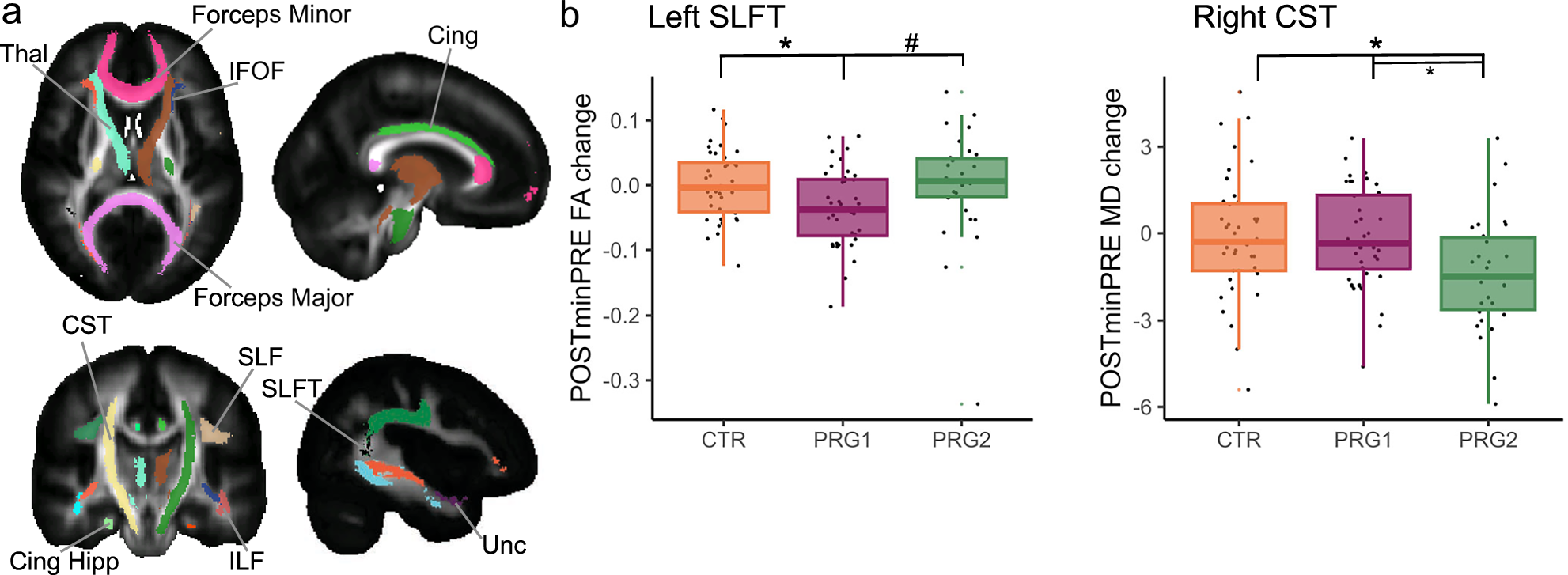 Fig. 4: Changes in white matter organization across a first and second pregnancy.