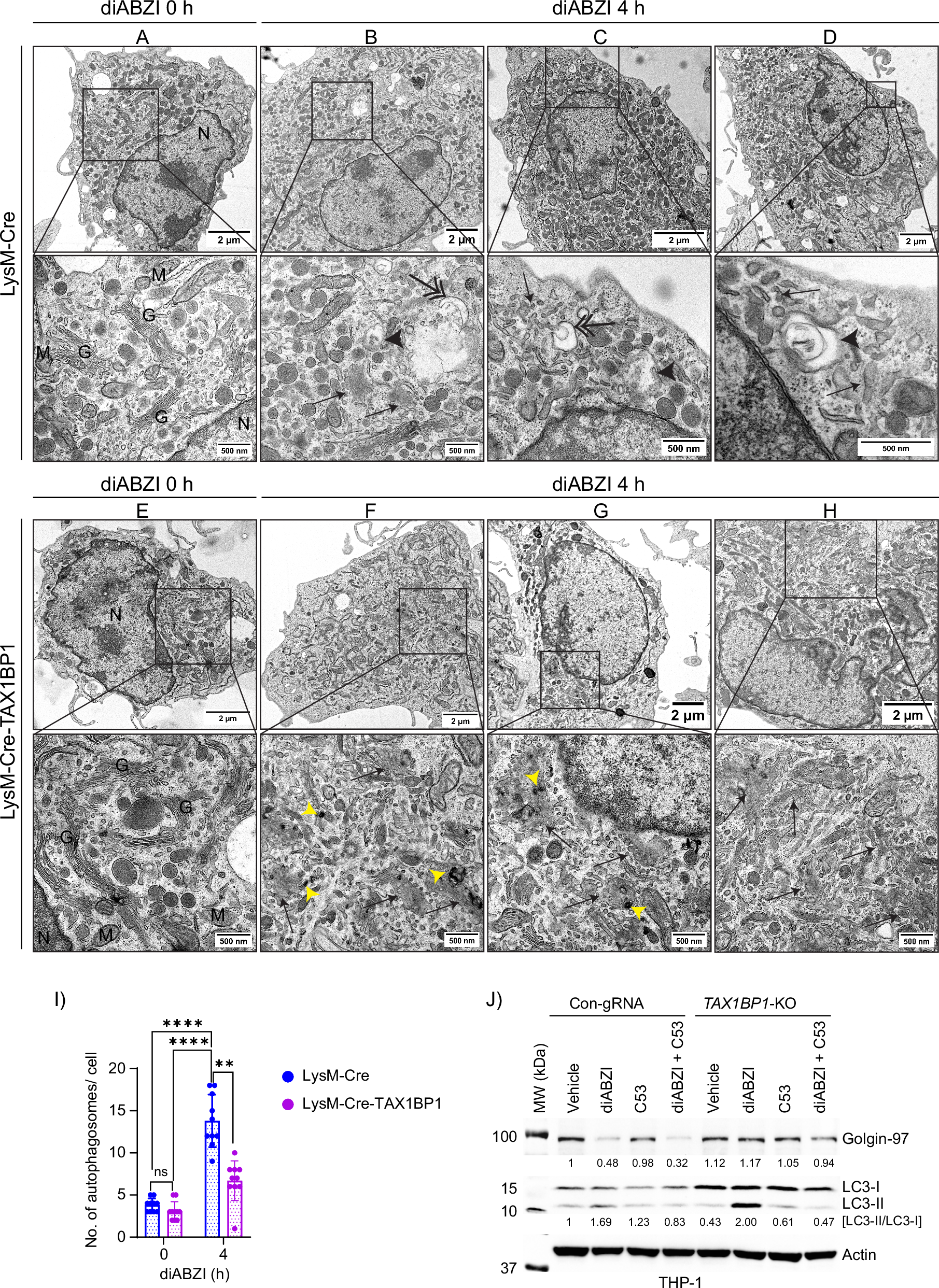 Fig. 9: TAX1BP1 knockout leads to the accumulation of fragmented Golgi upon STING activation.