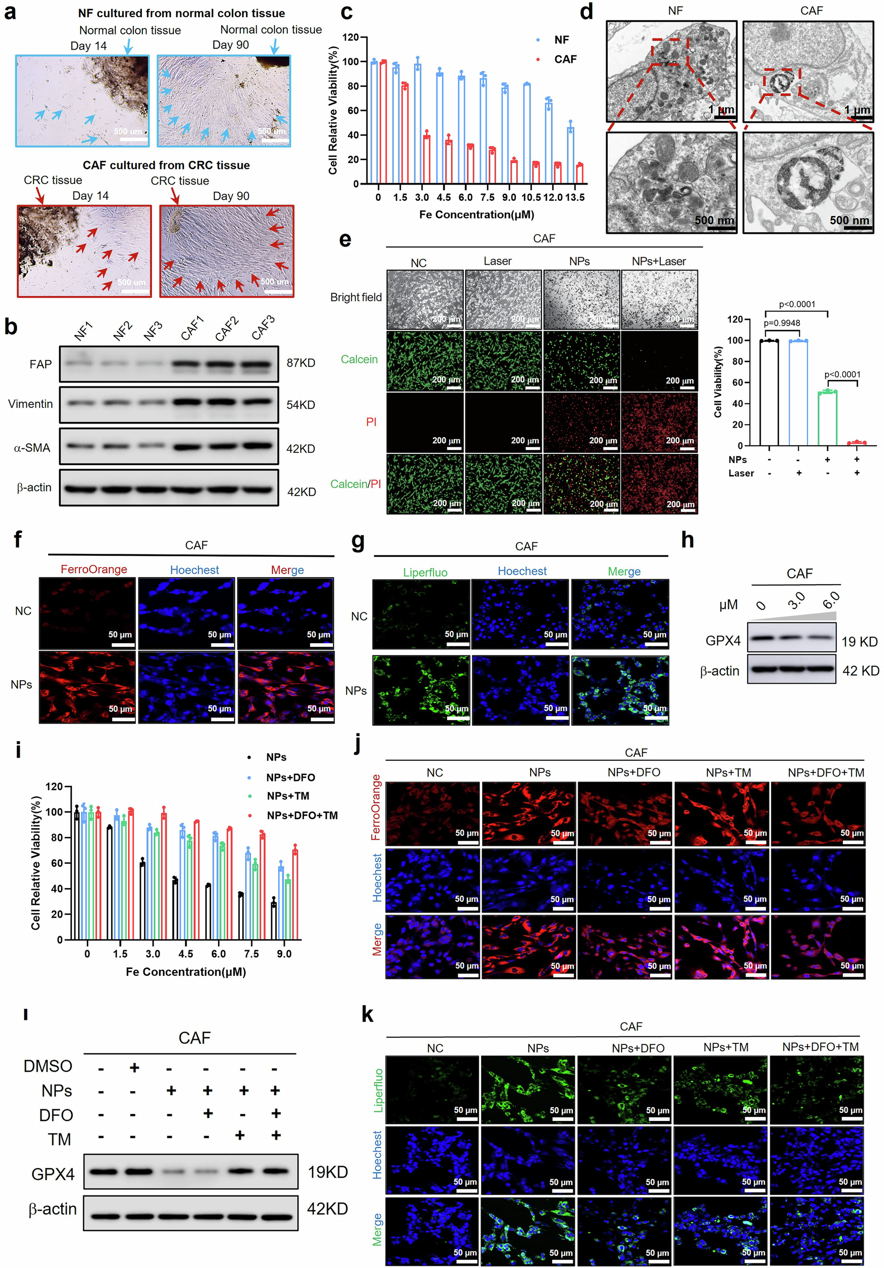 Fig. 2: NPs triggered enhanced ferroptosis of CAFs through the synergistic effect of iron and copper ions.