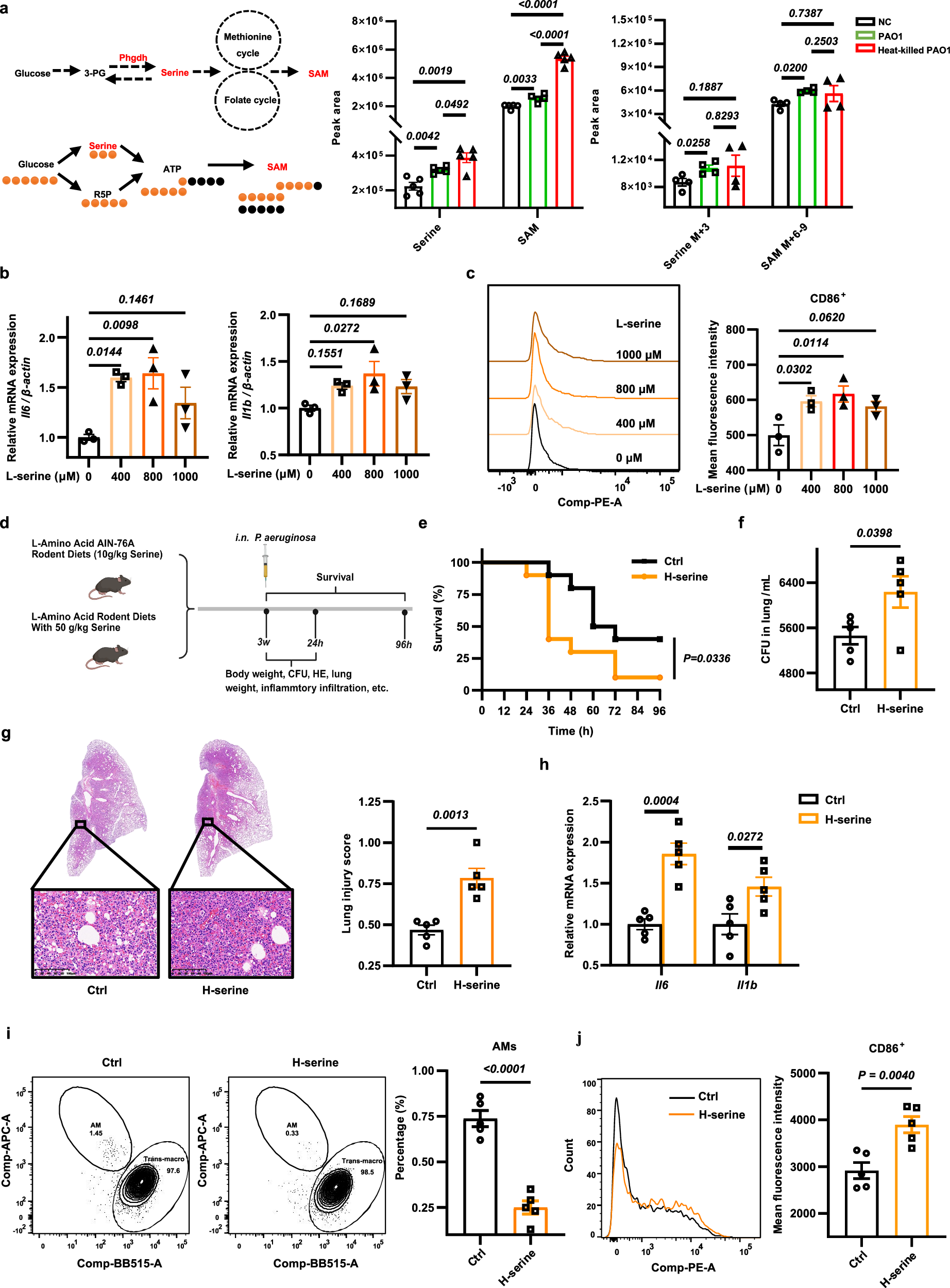 Fig. 4: L-serine in macrophages is related with hyperinflammation and poor prognosis of P. aeruginosa lung infection.