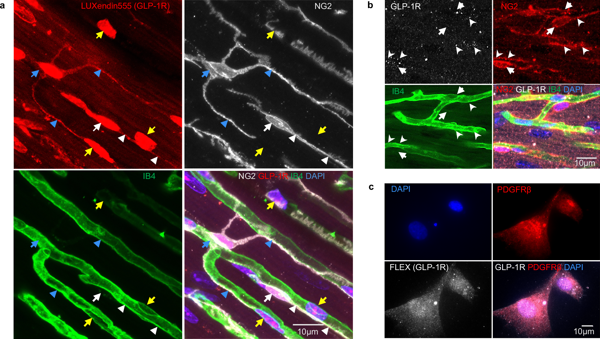 gg trend glp 1 reviews GLP-1 activates KATP channels in coronary pericytes as the effector of  brain-gut-heart signalling mediating cardioprotection
