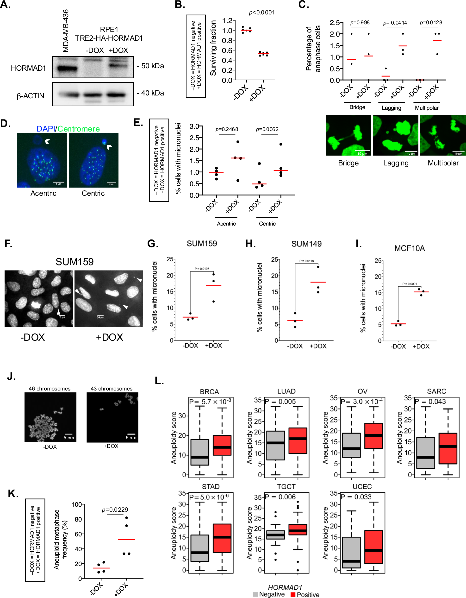 Fig. 1: HORMAD1 expression causes chromosomal instability and aneuploidy.