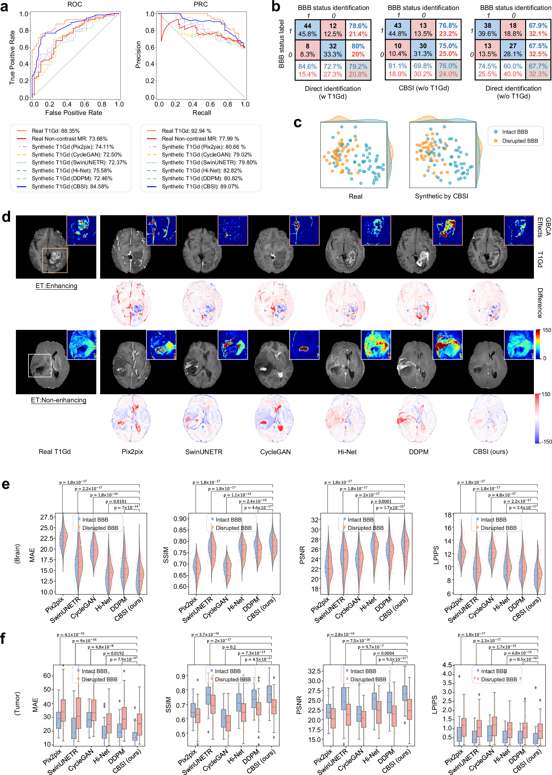 Fig. 3: T1Gd synthesis and BBB status identification performance on the MR-1 testing set (n = 96 samples).