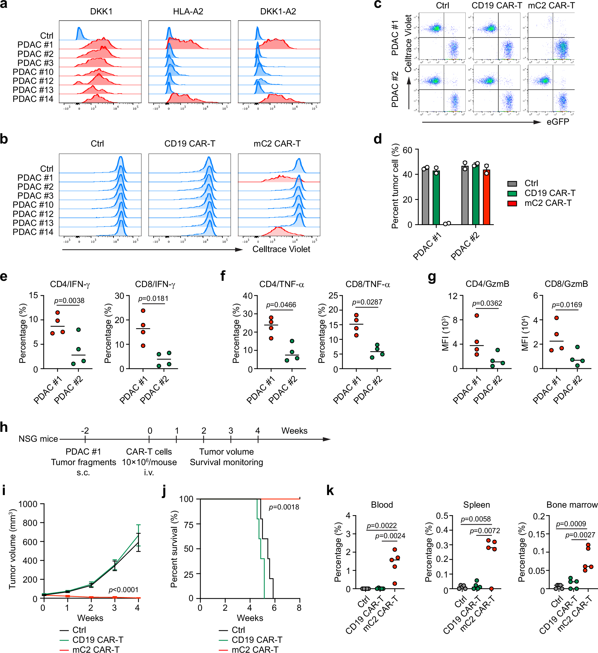 Fig. 4: In vivo anti-tumor effects of DKK1-A2 CAR-T cells in human PDAC PDX model.