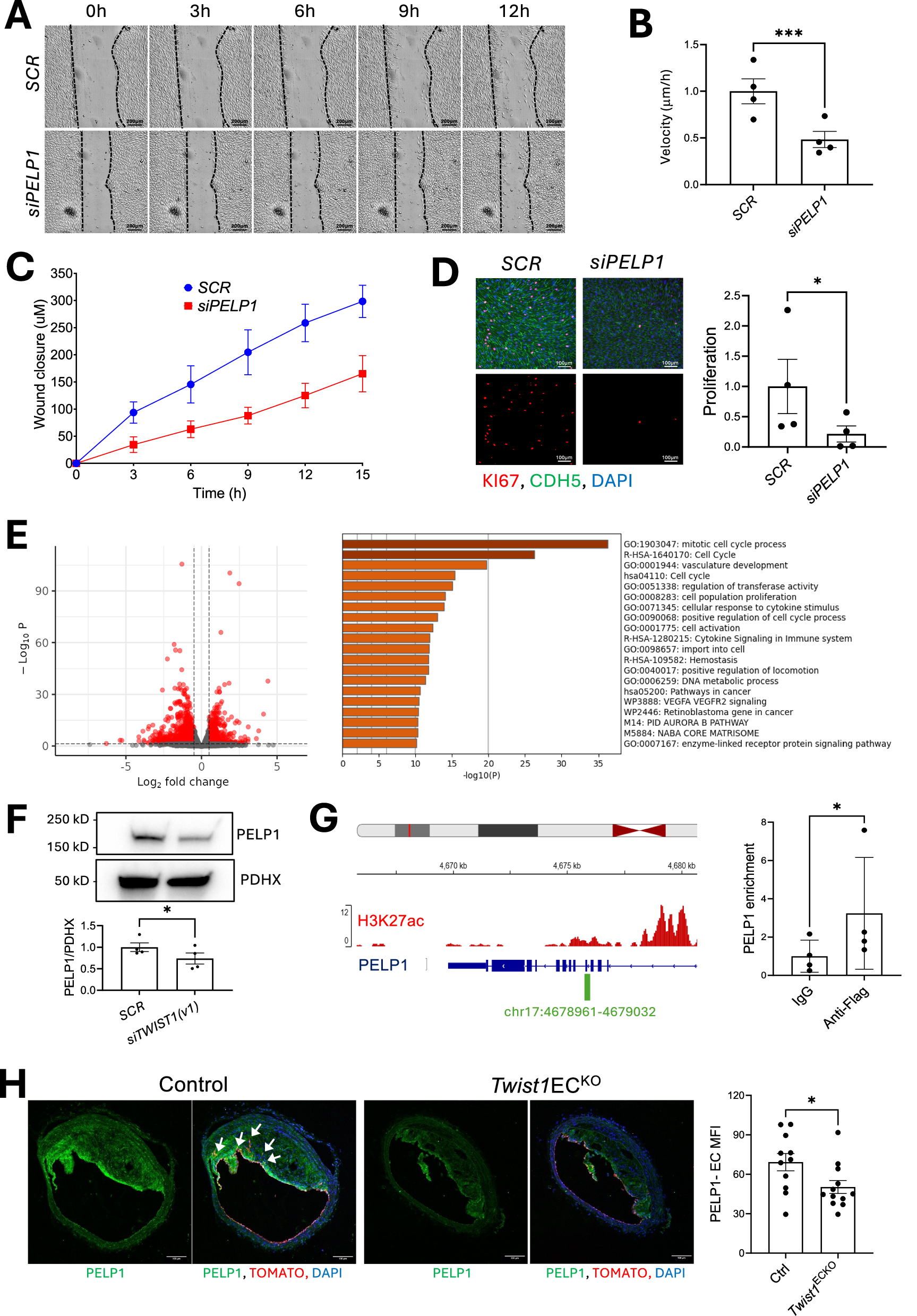 Fig. 4: TWIST1 promotes migration and proliferation via PELP1.