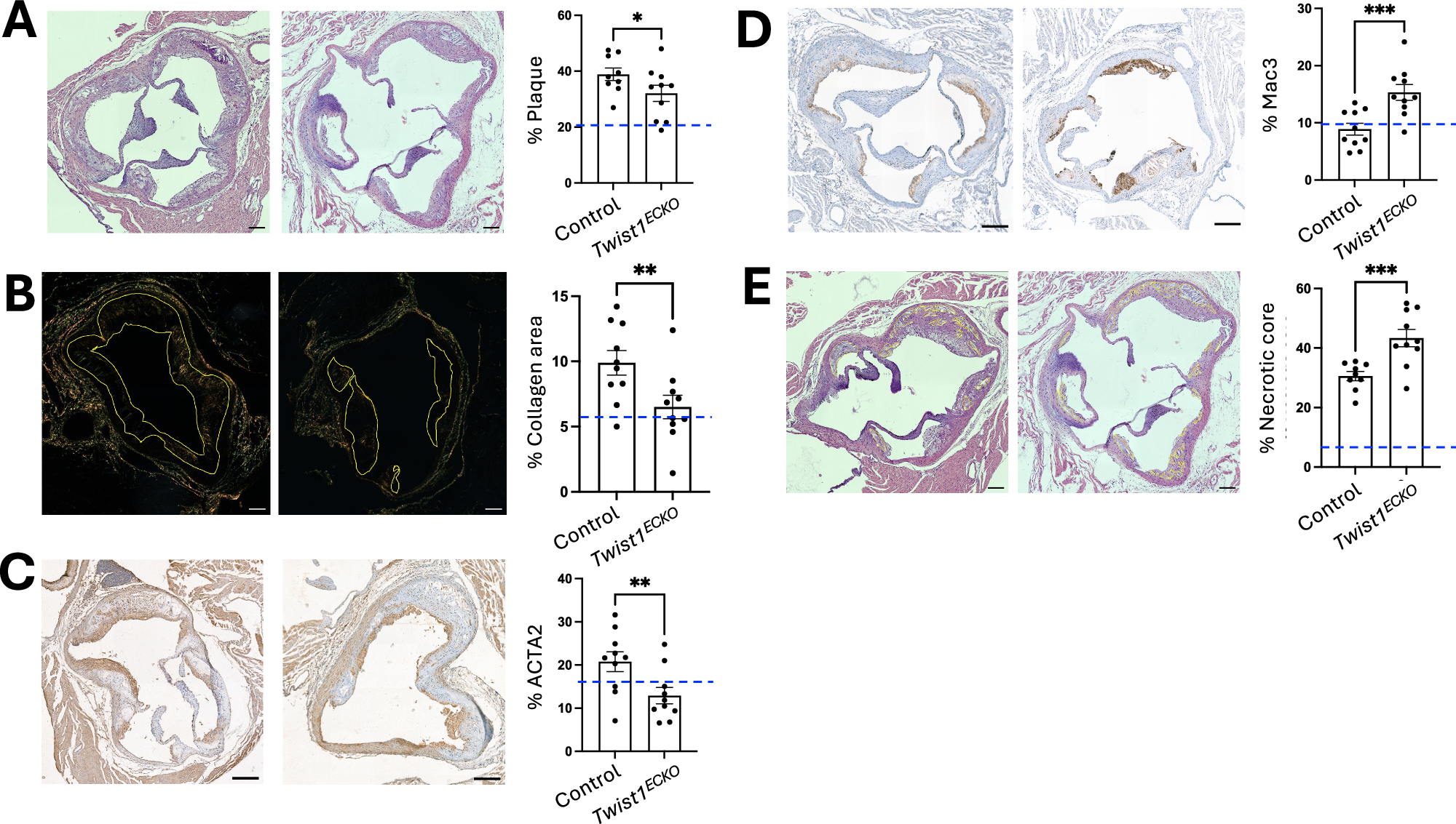 Fig. 7: Twist1 promotes aortic root plaque growth and features of stability in vivo.