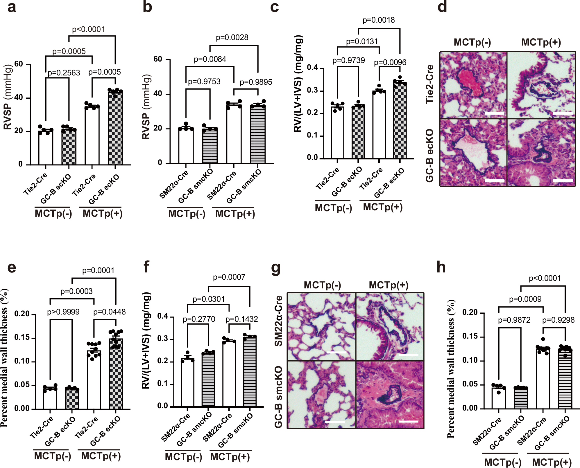 Fig. 2: GC-B signaling in endothelial cells, but not smooth muscle cells, prevents the progression of pulmonary hypertension in the MCTp-induced PAH model.