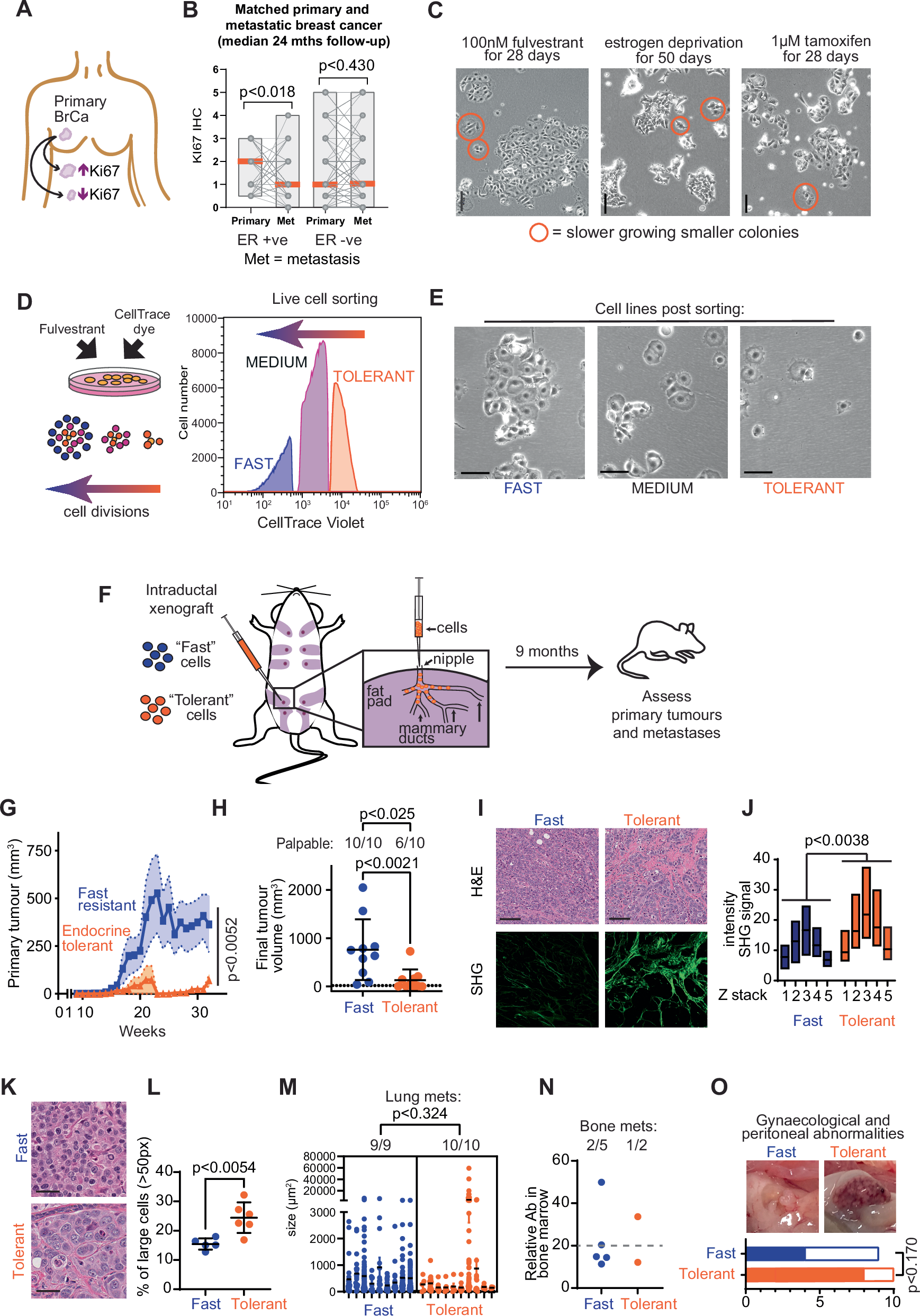 Endocrine therapy reprogramming of breast cancer facilitates metastatic escape via upregulation of P-Rex1/Rac1 signalling