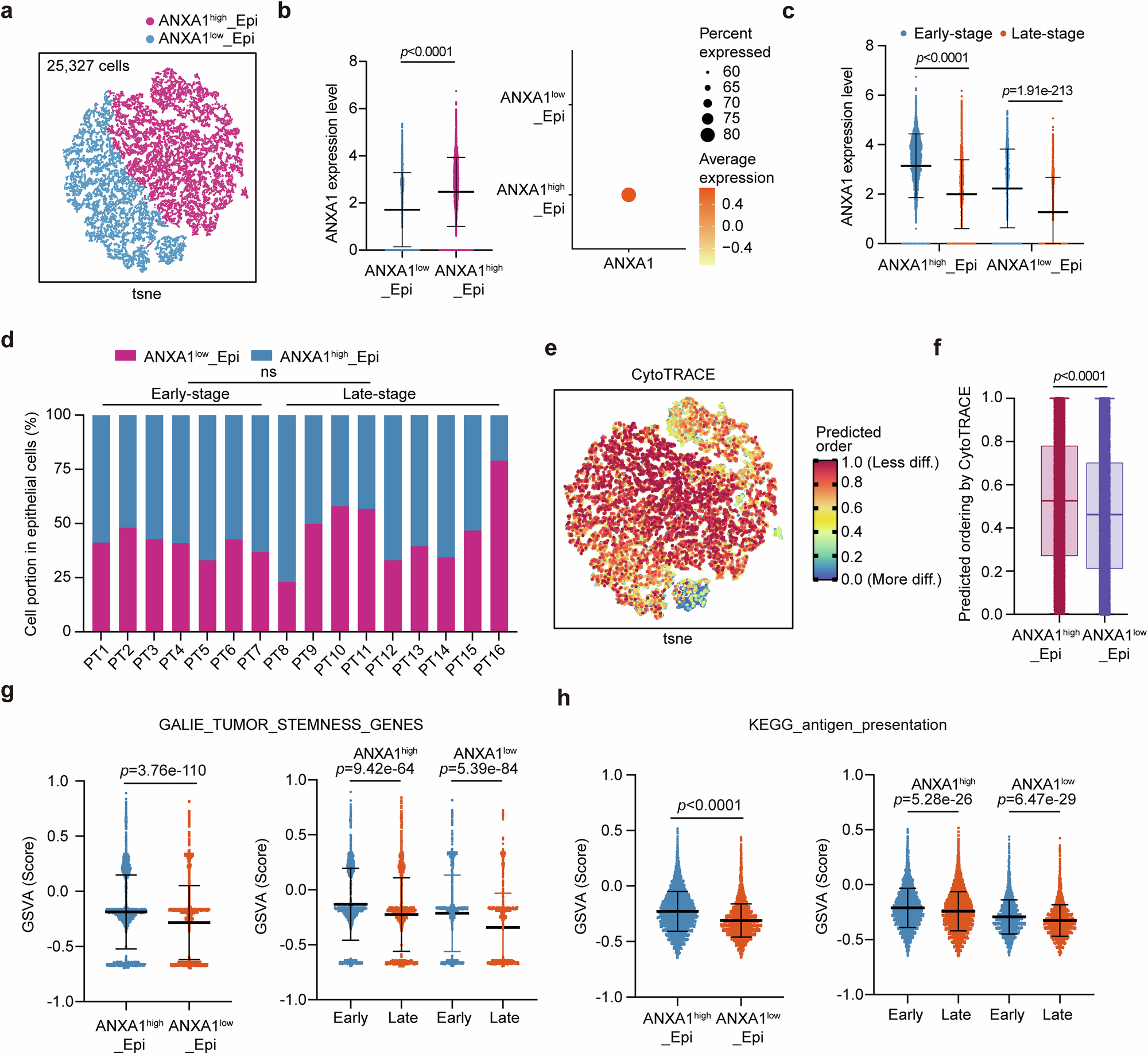 Fig. 7: ANXA1high epithelial tumor cells facilitate communication with myeloid cells.