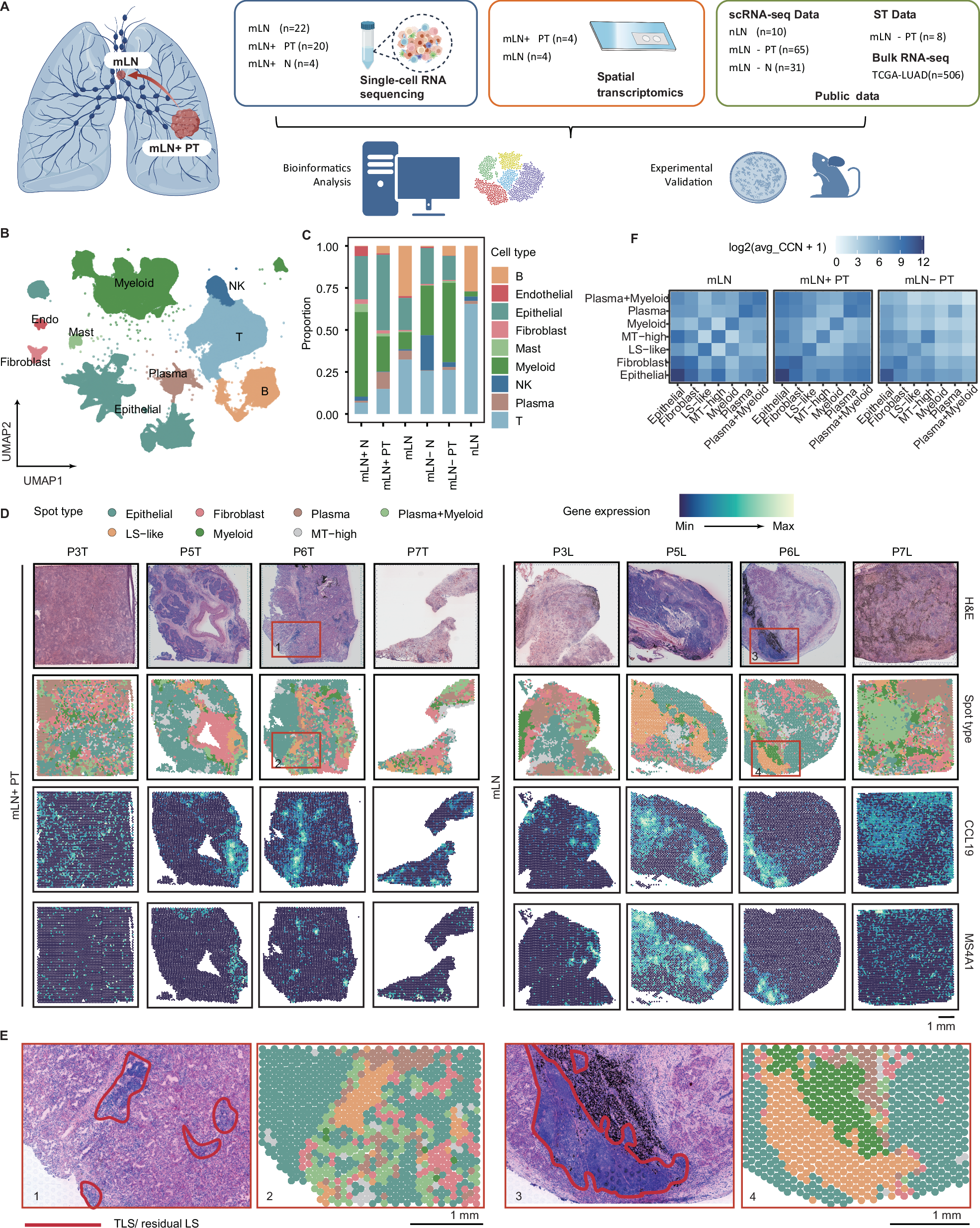 Dissecting origin factors of lymph node metastasis in non-small 