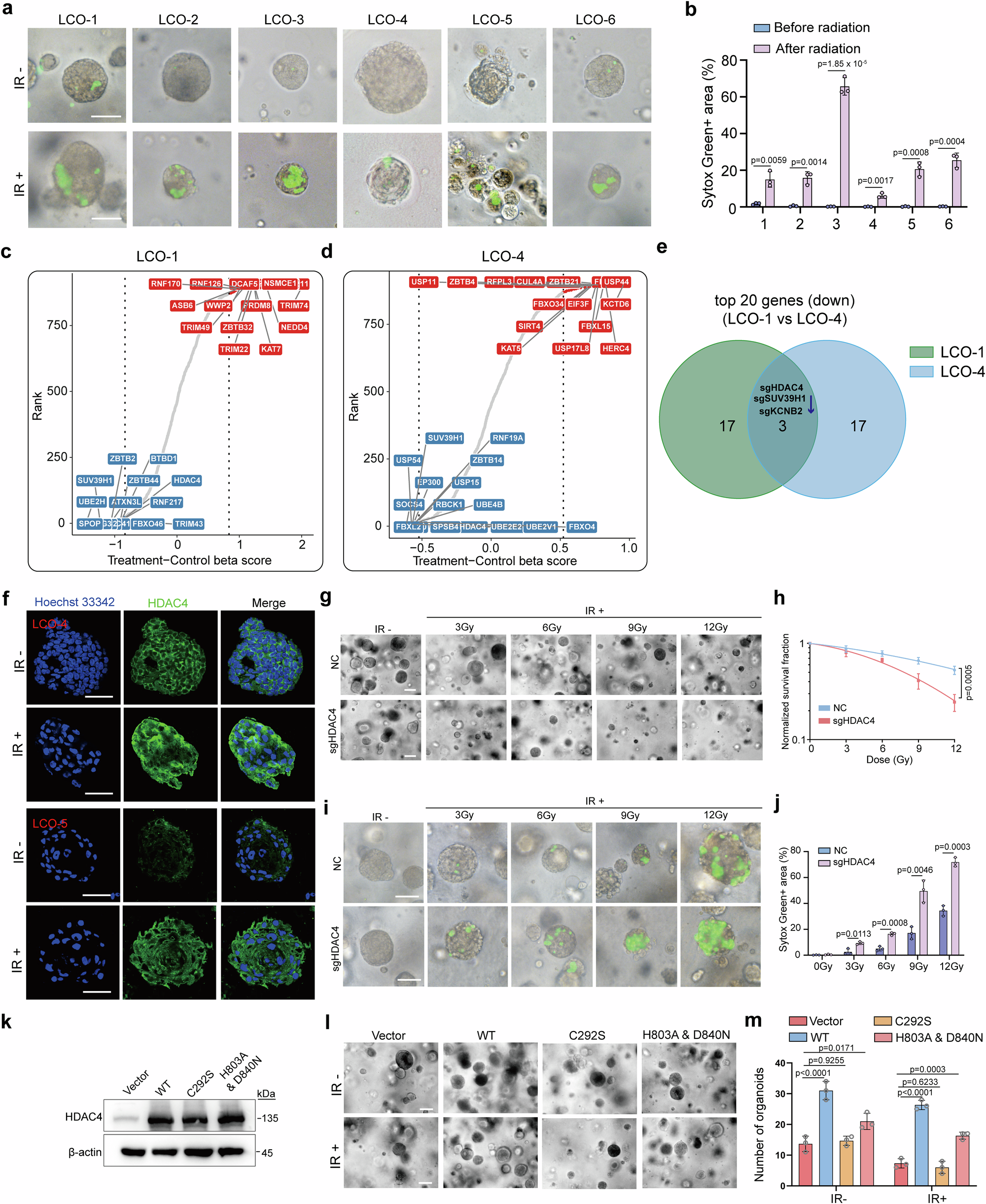ac glutathione k117 An HDAC4-specific PROTAC degrader achieves radiation sensitization by enhancing ferroptosis in lung cancer Psc:1 Psc