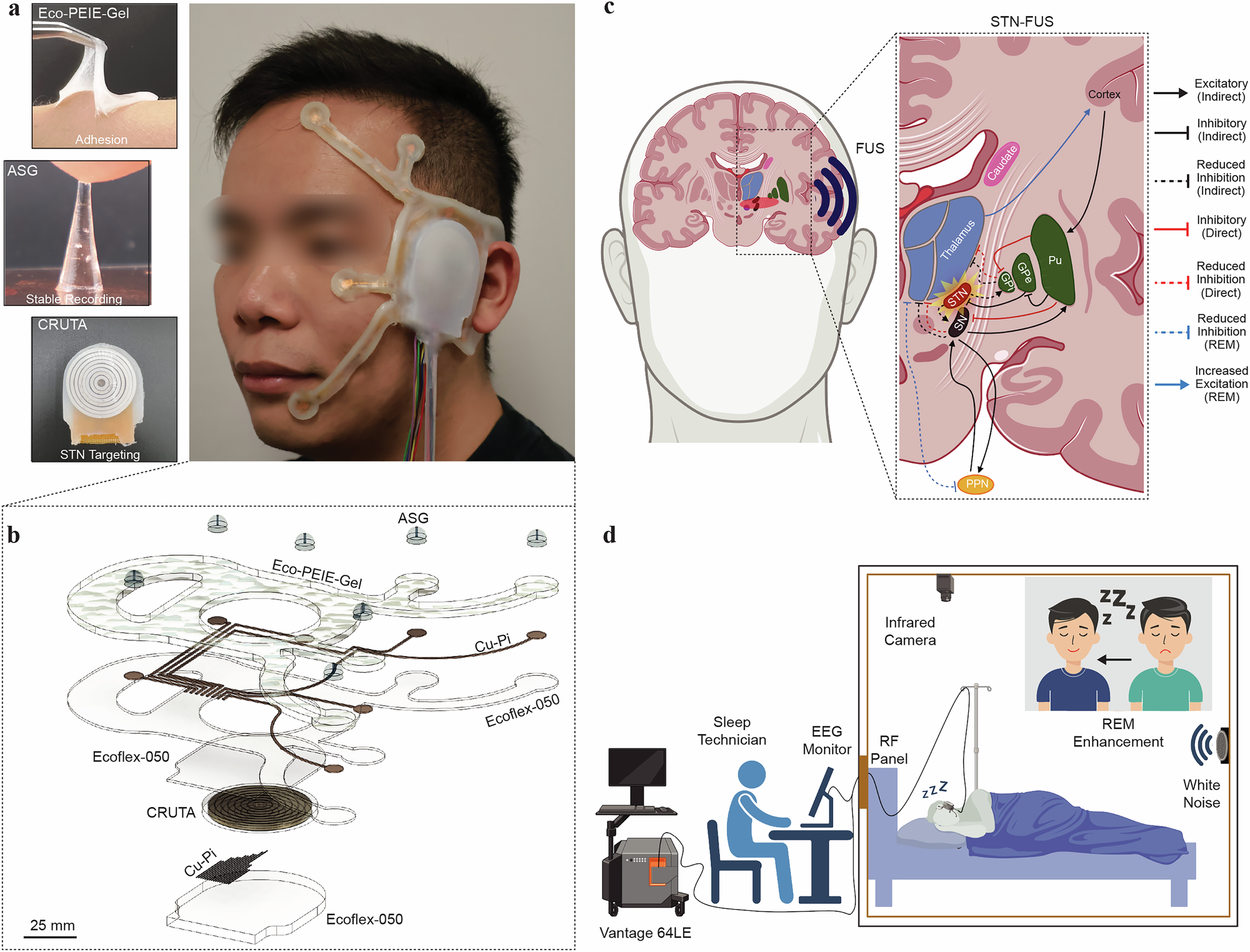 Skin-attached bioadhesive patch enabling ultrasound deep brain stimulation and real-time electrophysiological monitoring for REM sleep enhancement