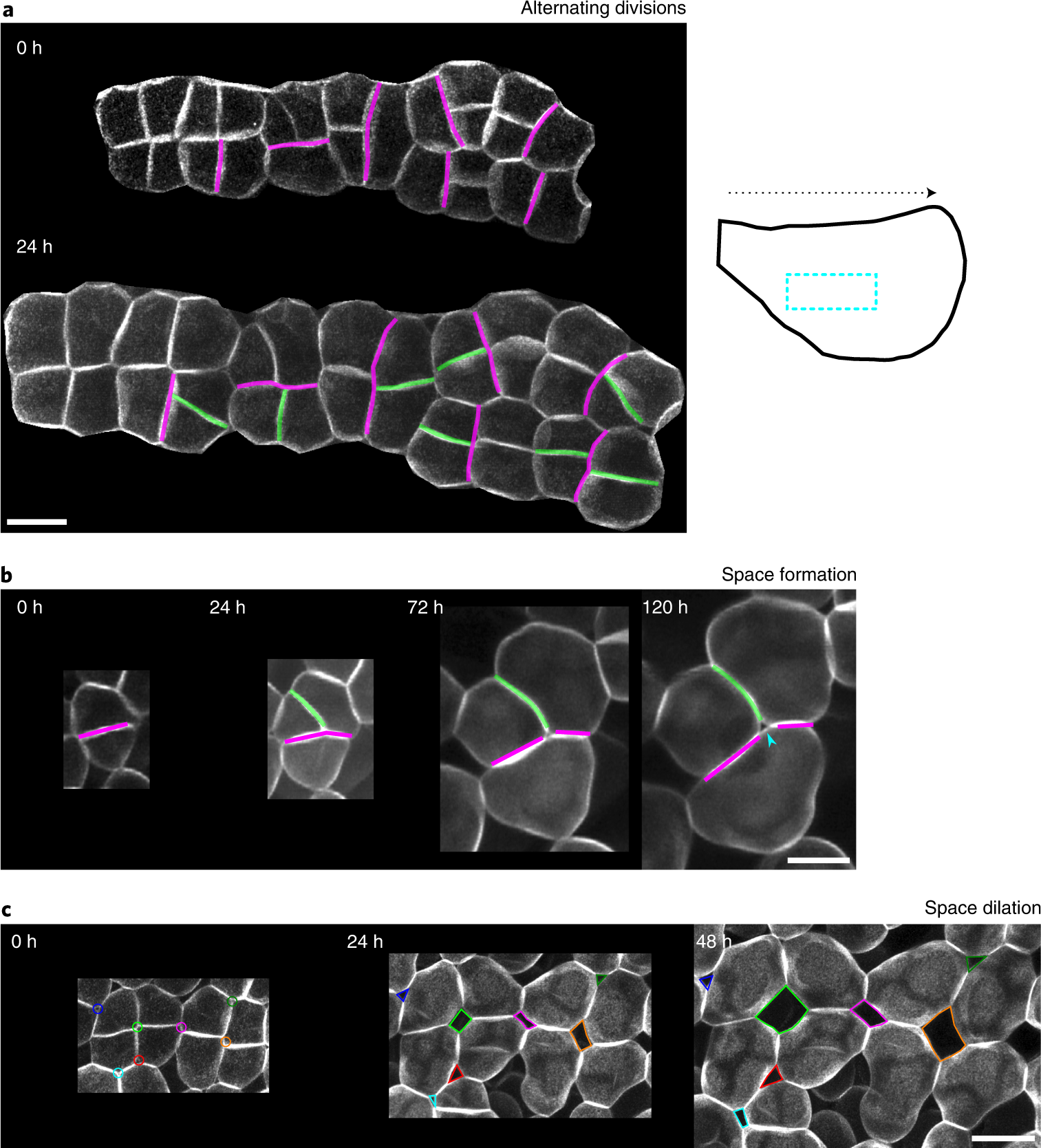CLASP balances two competing cell division plane cues during leaf  development | Nature Plants