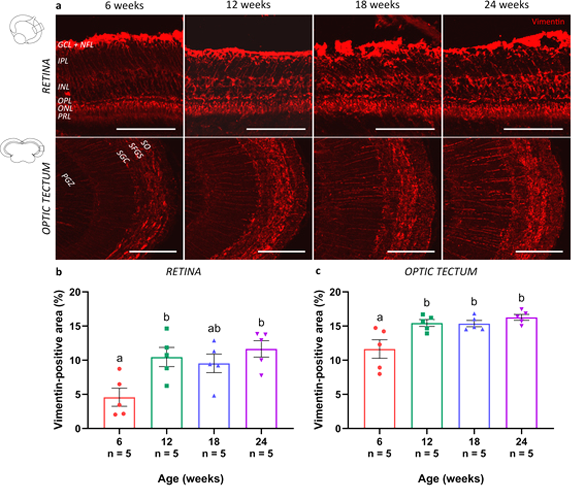 Fig. 5: Reactive gliosis in the visual system of the aged killifish.