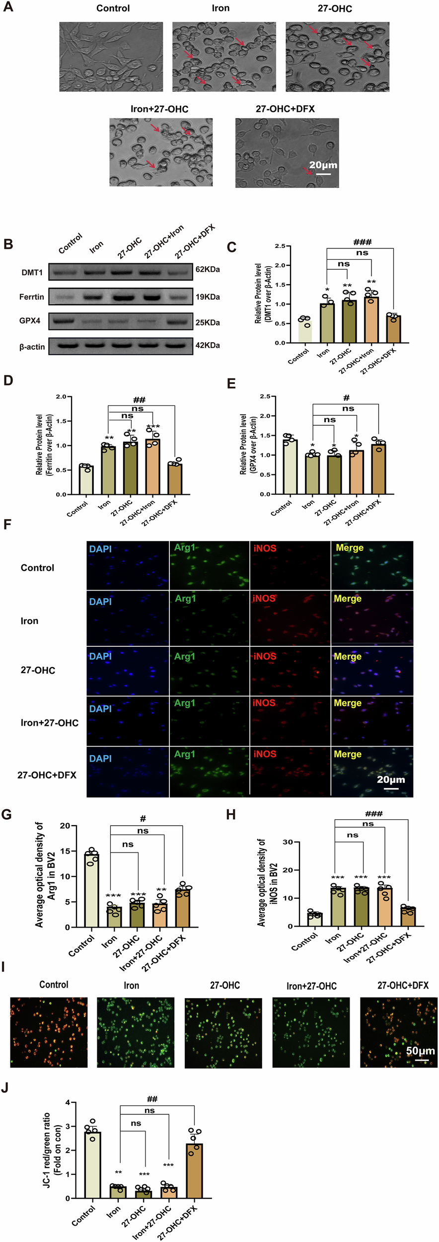 Fig. 8: Interventive effect of DFX on iron metabolism in BV-2 cells.