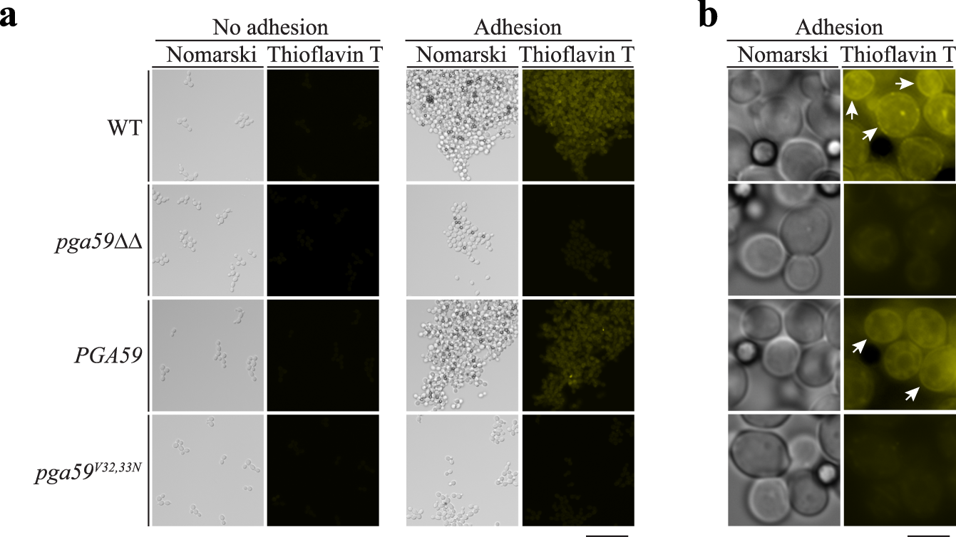 Fig. 4: C. albicans assembly of amyloid structures upon adhesion requires Pga59.