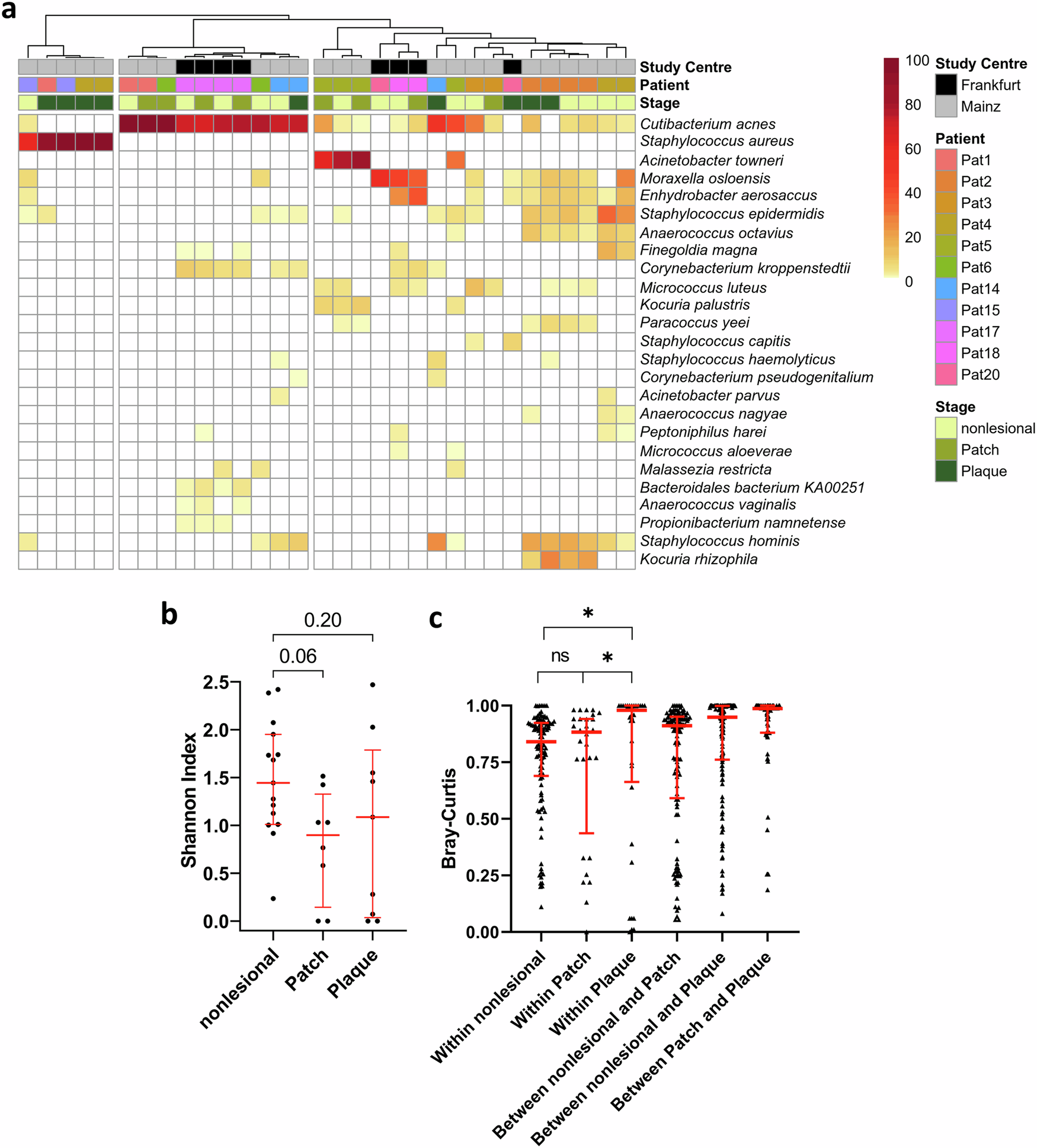 The skin microbiome stratifies patients with cutaneous T cell lymphoma and determines event-free survival | npj Biofilms and Microbiomes the-skin-microbiome-stratifies-patients-with-cutaneous-t-cell-lymphoma-and-determines-event-free-survival-npj-biofilms-and-microbiomes
