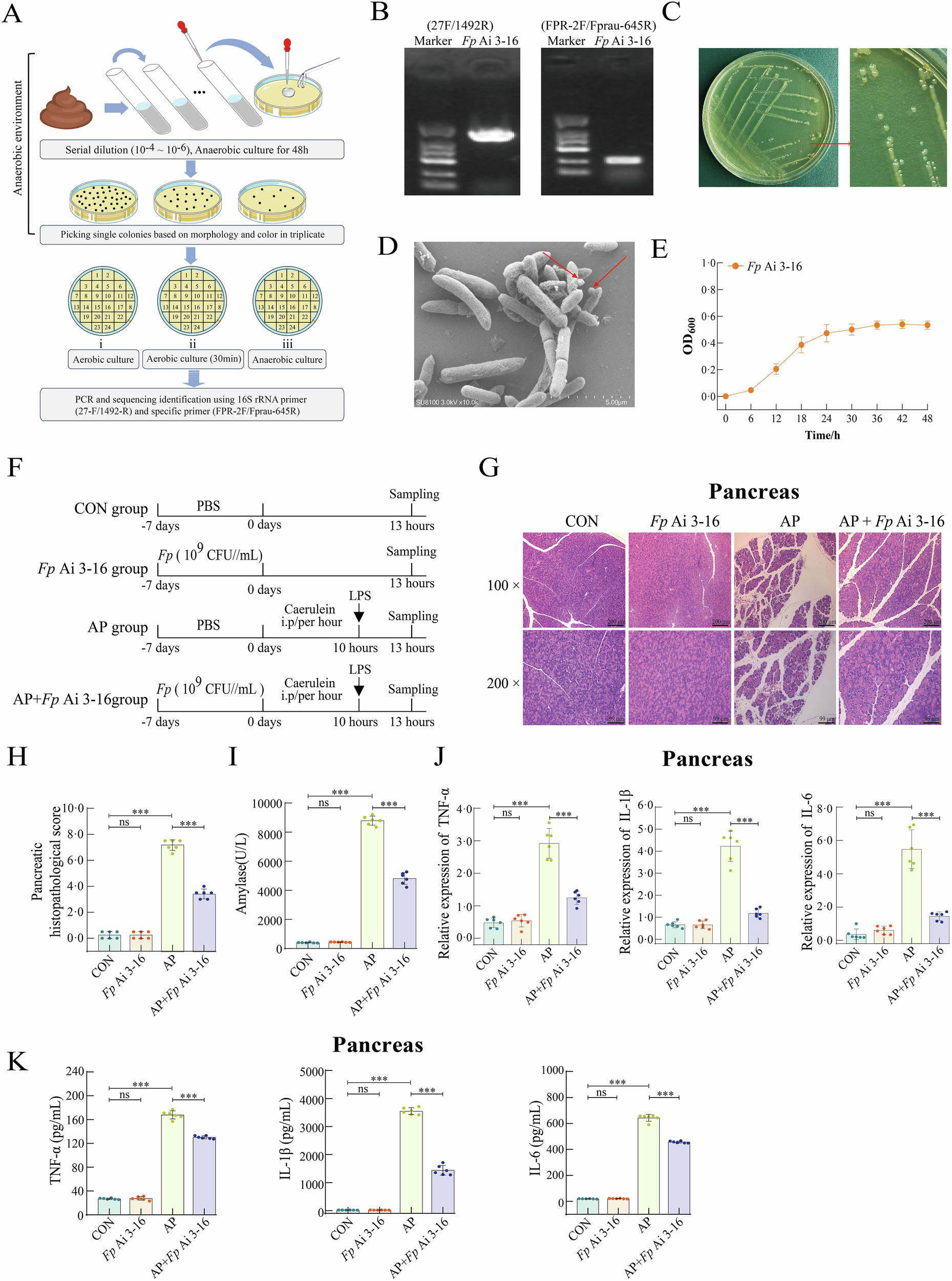 Fig. 2: The isolated Faecalibacterium prausnitzii Ai 3-16 and its alleviating effect on the pancreas during acute pancreatitis induced by caerulein plus lipopolysaccharide.