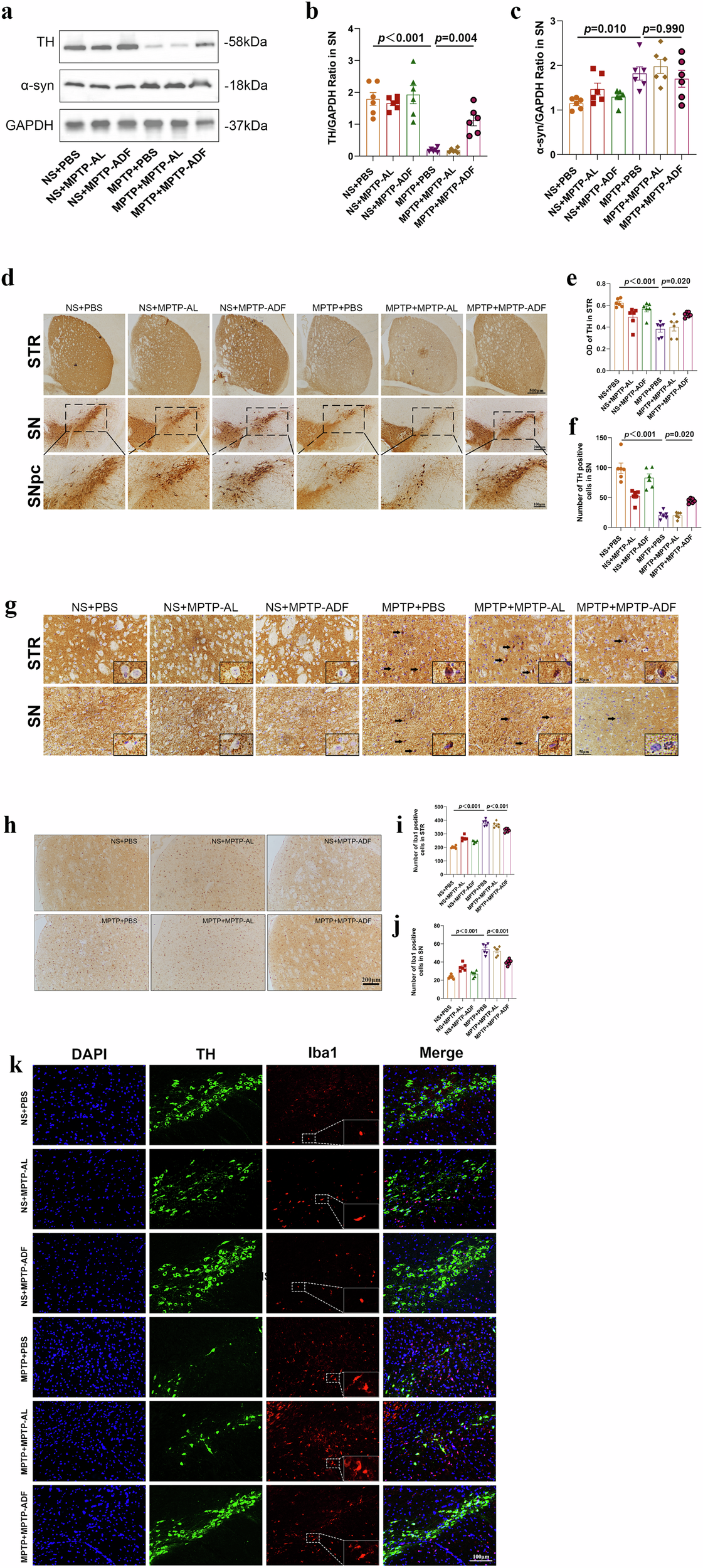 Fig. 9: The neuroprotective effect of ADF could be achieved partly through FMT.