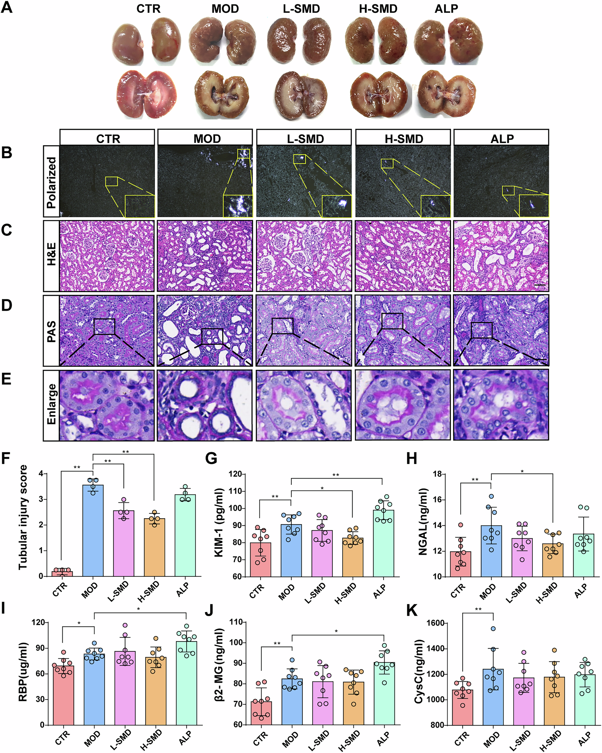 Fig. 2: SMD attenuates renal histopathological injury in the UOX-/- rats.