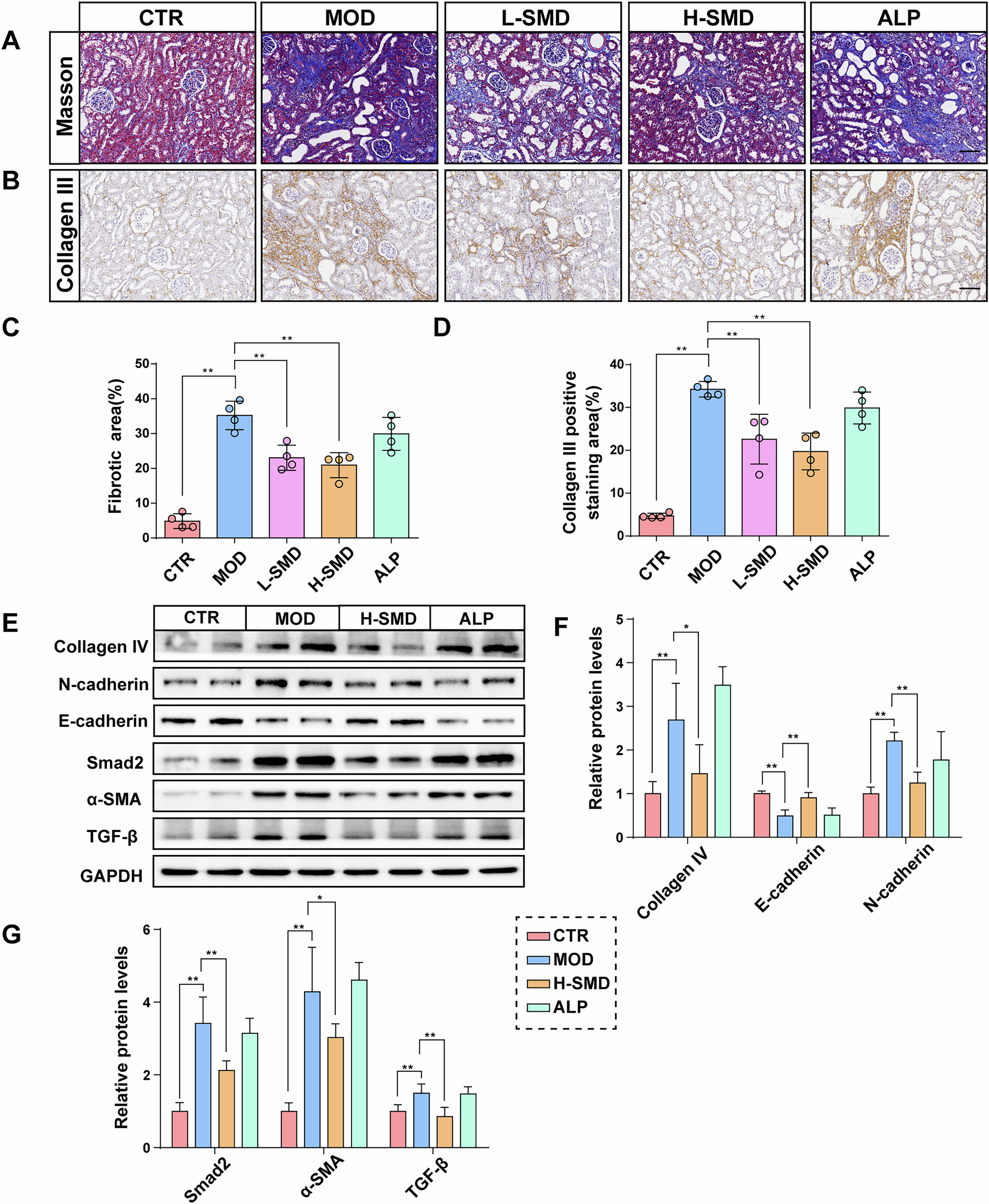 Fig. 3: SMD alleviates renal fibrosis in the UOX−/− rats.