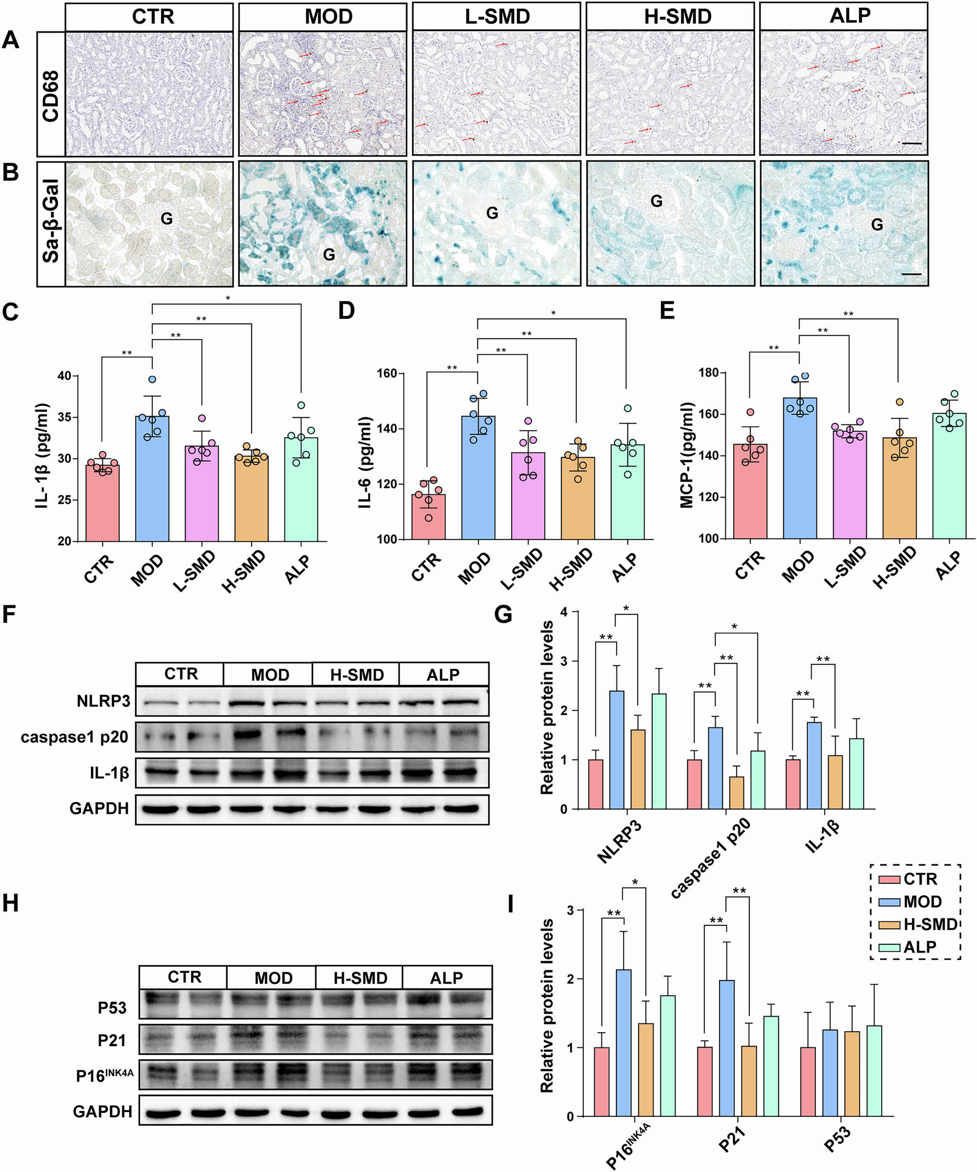 Fig. 4: SMD inhibits inflammation and cellular senescence in the kidneys of UOX−/− rats.