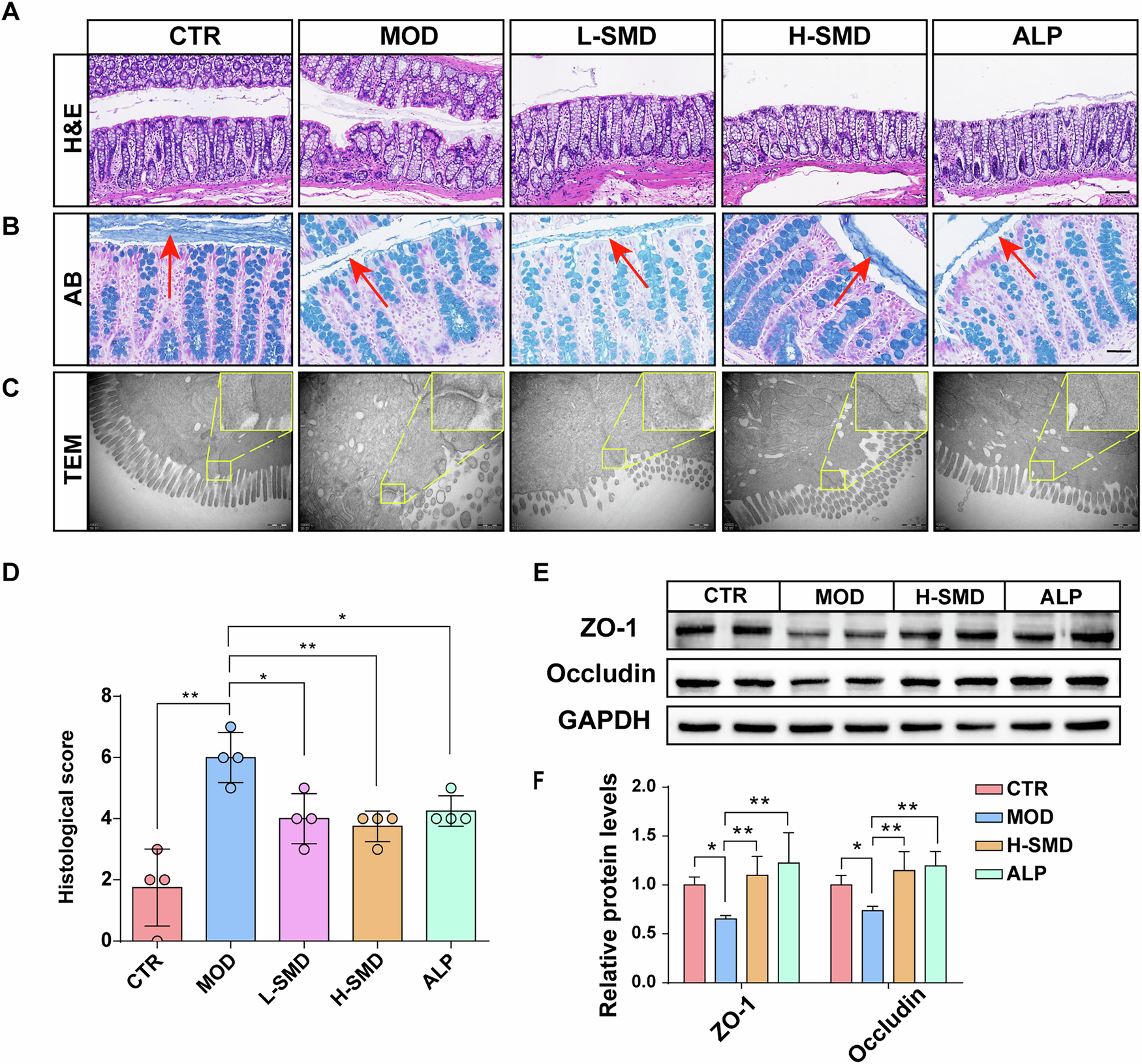 Fig. 5: SMD improves intestinal barrier in the UOX−/− rats.