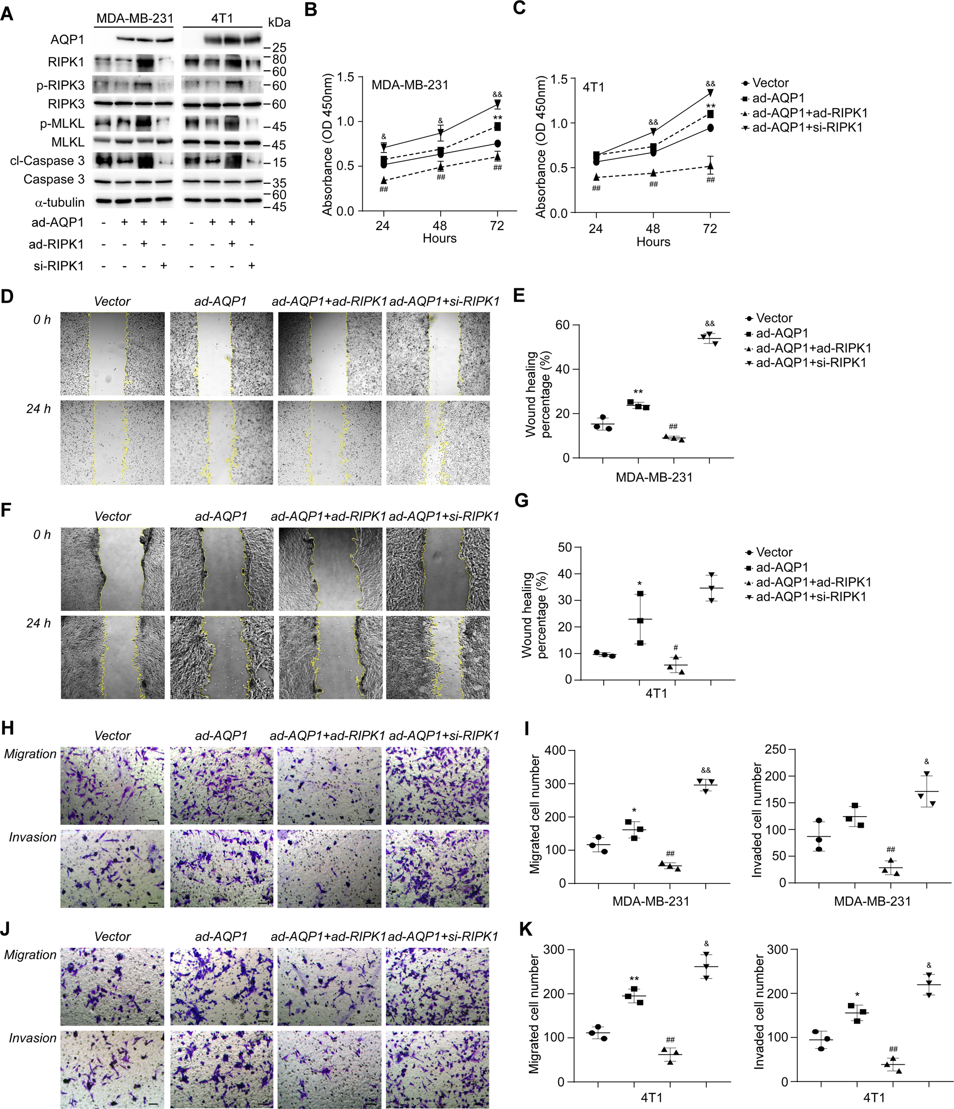 Fig. 4: Inhibition of RIPK1 is required for AQP1-driven TNBC cell proliferation, migration, and invasion in vitro.