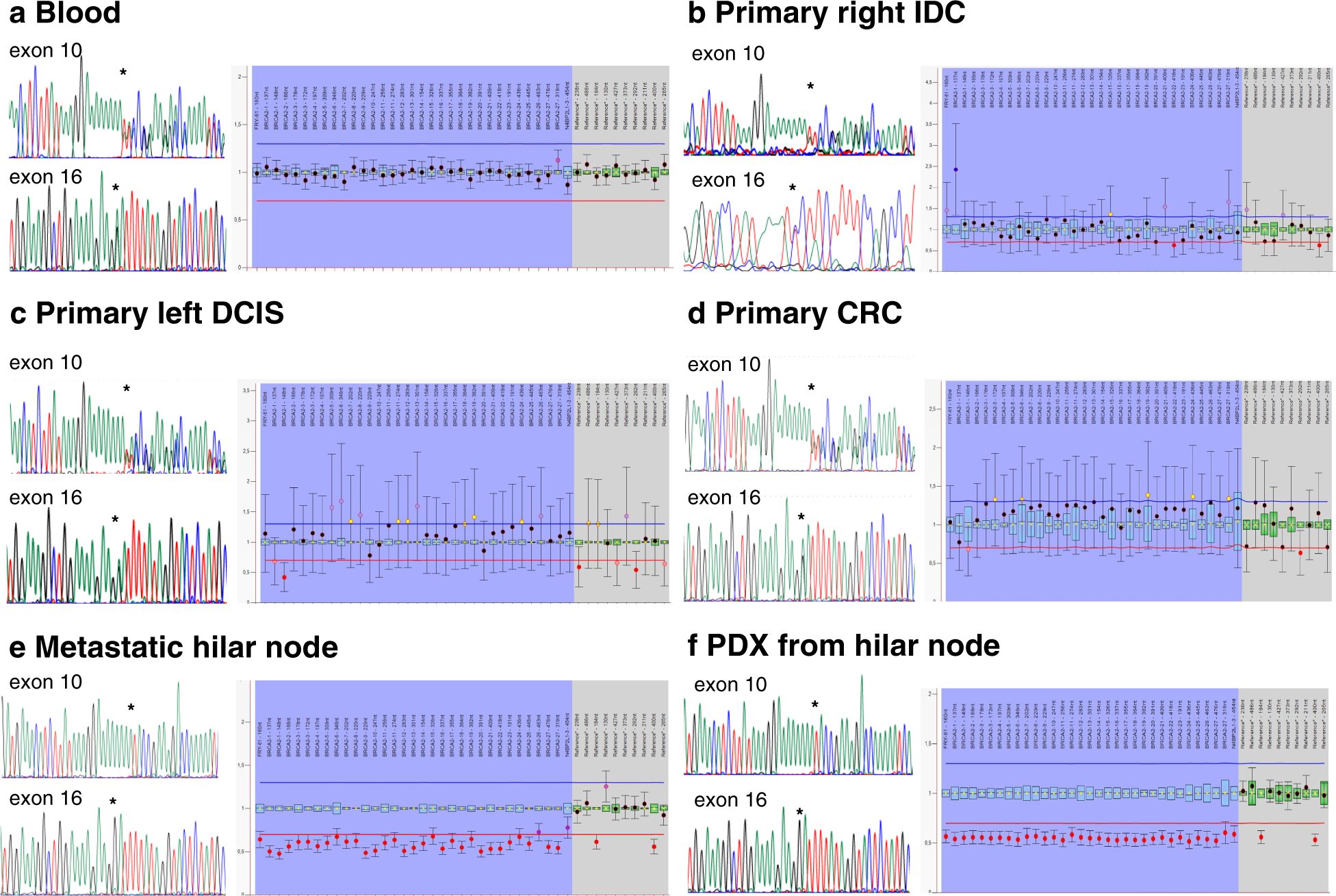 Fig. 3: Sanger sequencing and MLPA results from normal and tumor samples indicate that the c.1813dup and c.7796 A > G BRCA2 variants are in trans.